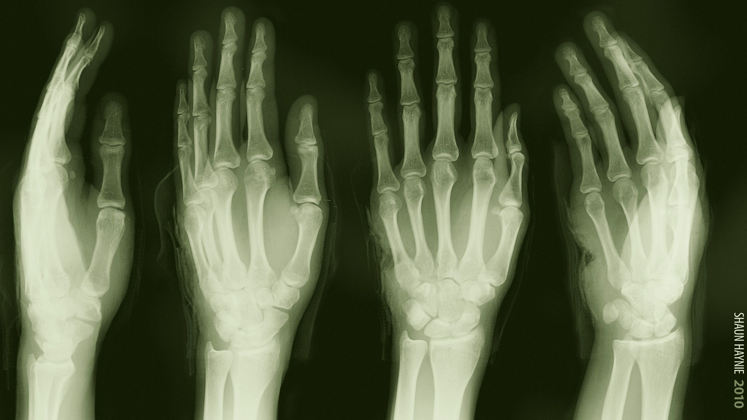 2560x1440 Desktop wallpaper: Medical, Photography, X Ray, Hand, X Ray Vision 4K free download for PC. 180110