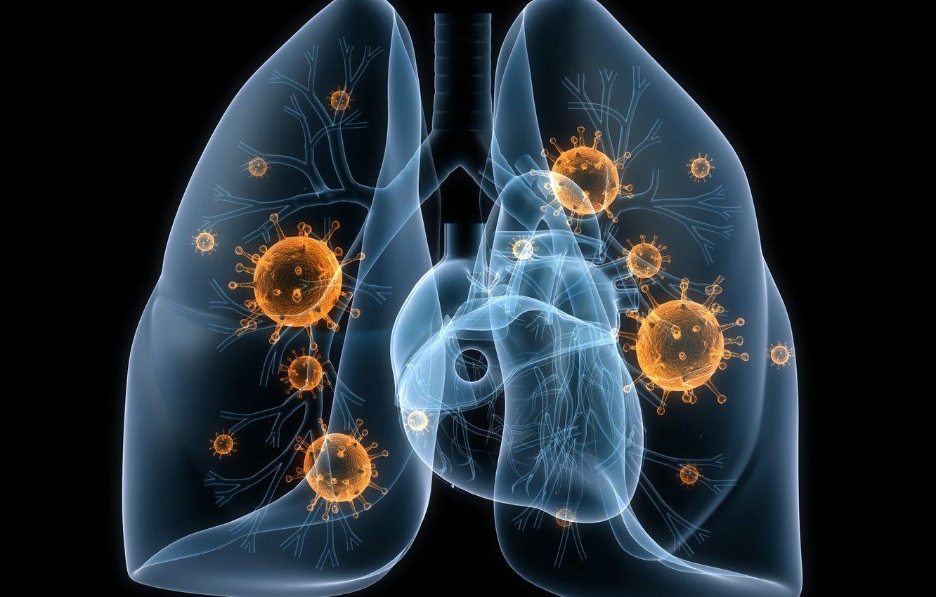1332x850 Wallpaper disease, lungs, viruses, bacteria image for desktop, section рендеринг