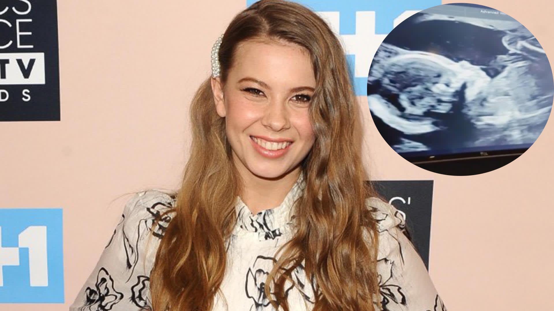 1920x1080 Bindi Irwin Shares Ultrasound Video of Baby Girl: She's So Beautiful