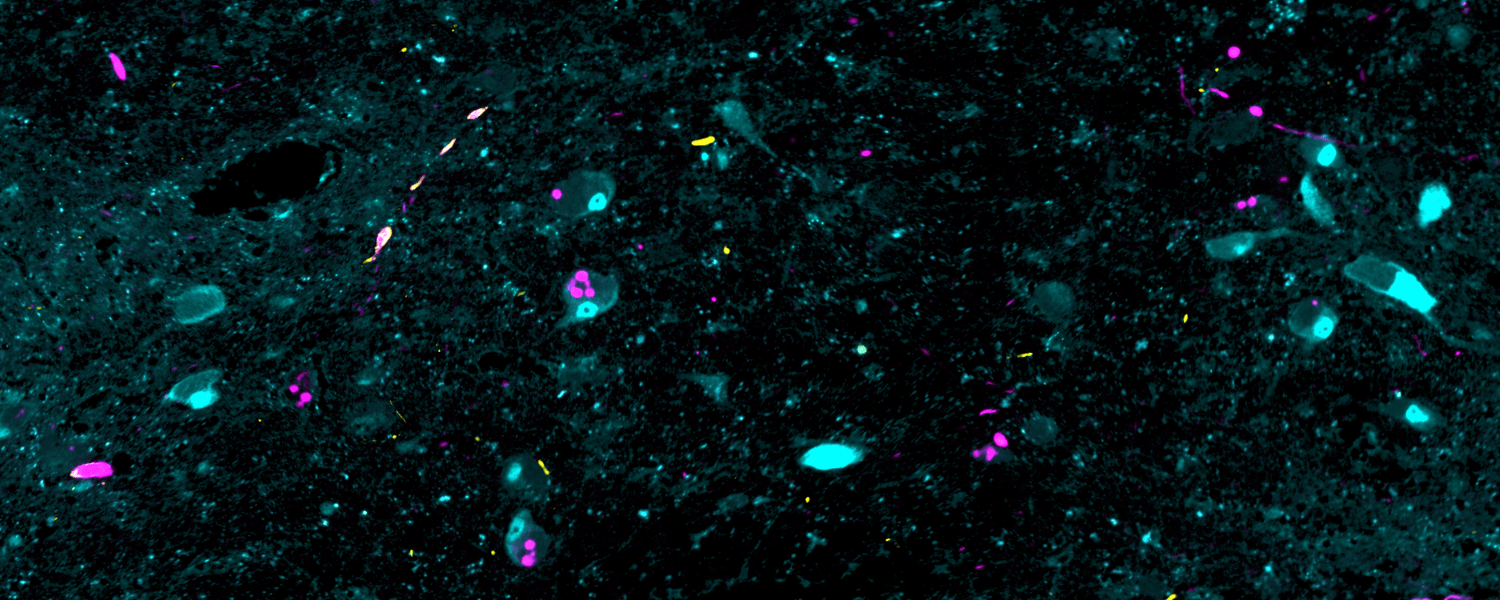 1500x600 Explainer: What Is Alpha Synuclein?