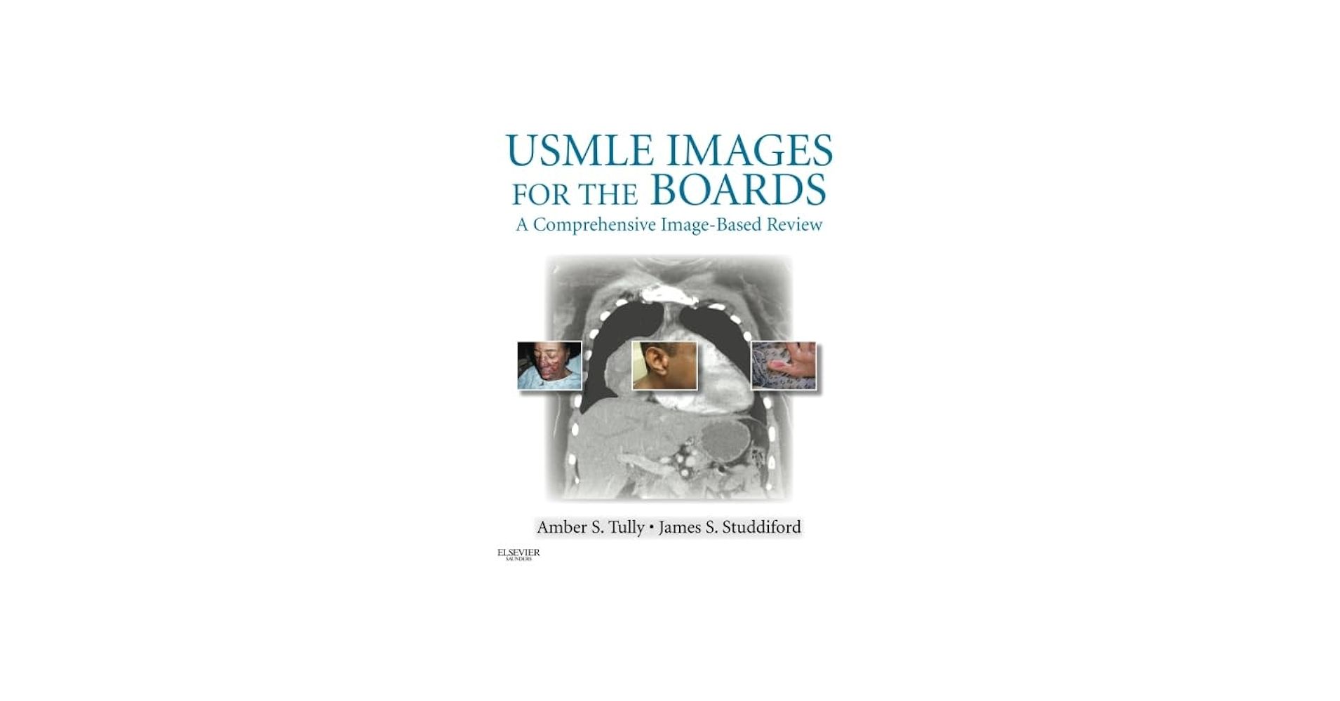 1910x1000 USMLE Image For The Boards: A Comprehensive Image Based Review: 9781455709038: Medicine & Health Science Books