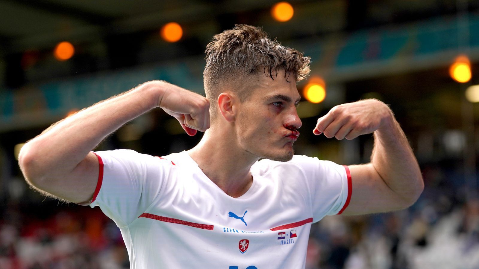 1600x900 Czech Republic's Star Striker Patrik Schick An Injury Doubt For Must Win Turkey Clash