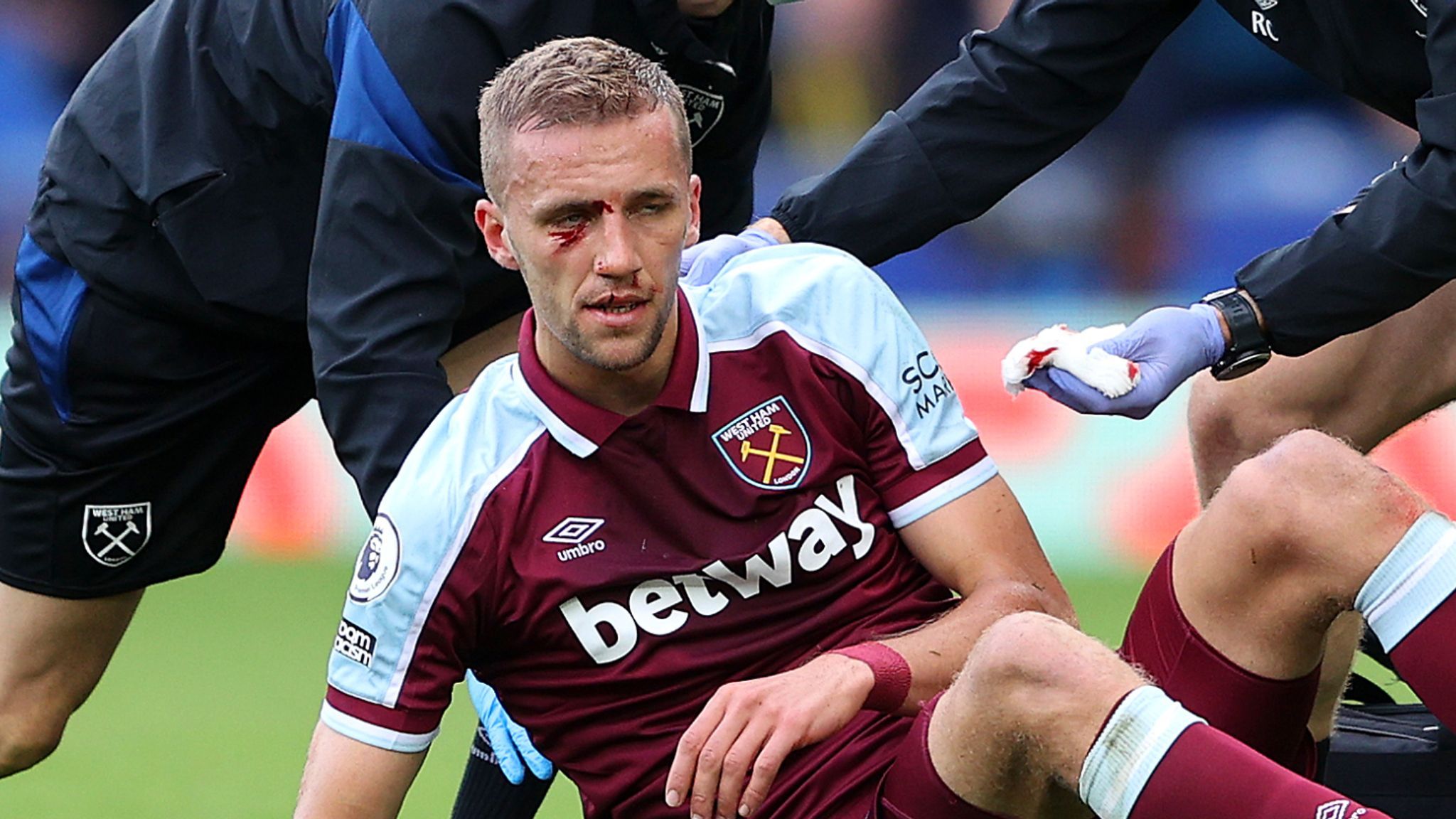 2048x1152 Tomas Soucek: West Ham midfielder needed plastic surgery on facial injury suffered against Everton
