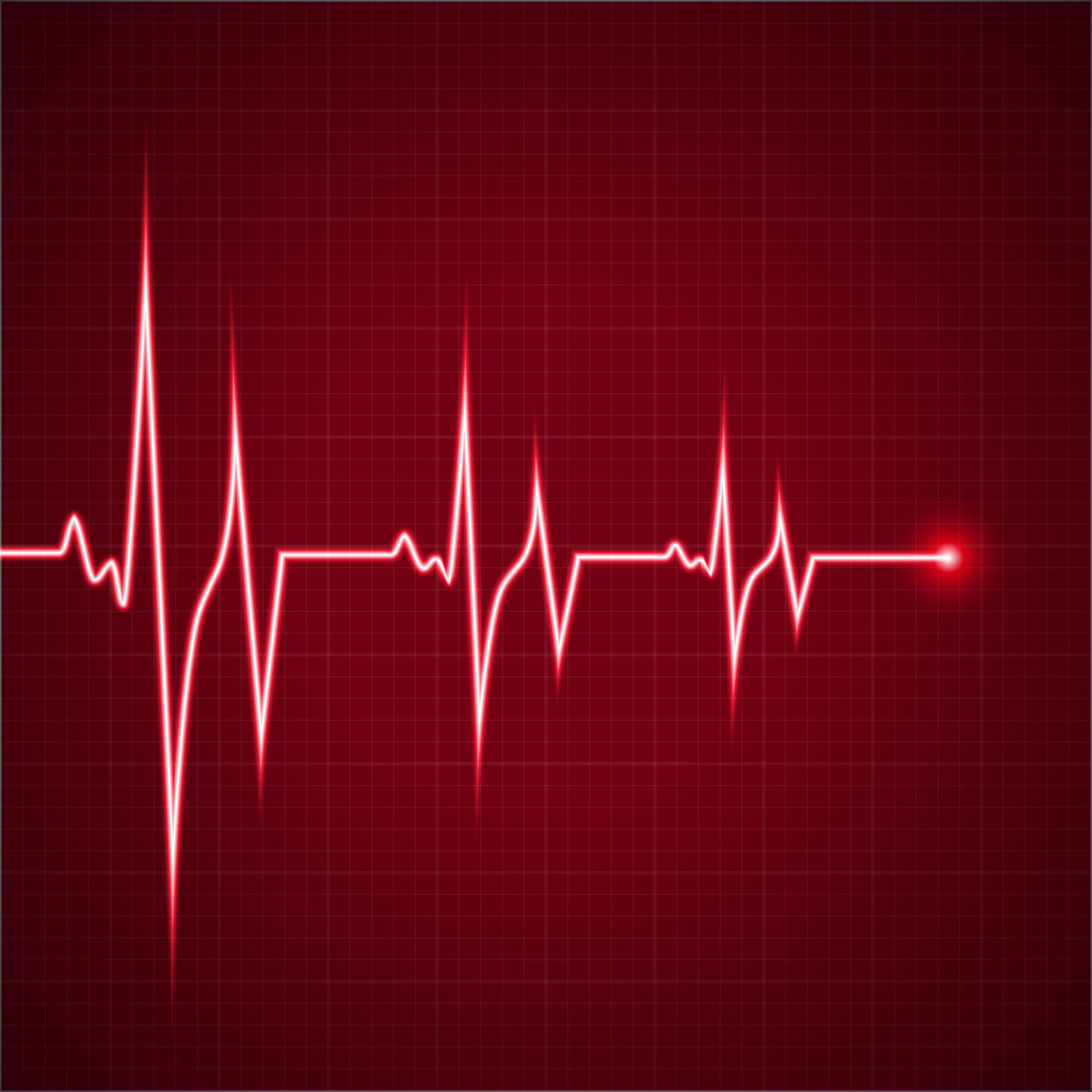 ECG Wallpapers Top Free ECG Backgrounds WallpaperAccess