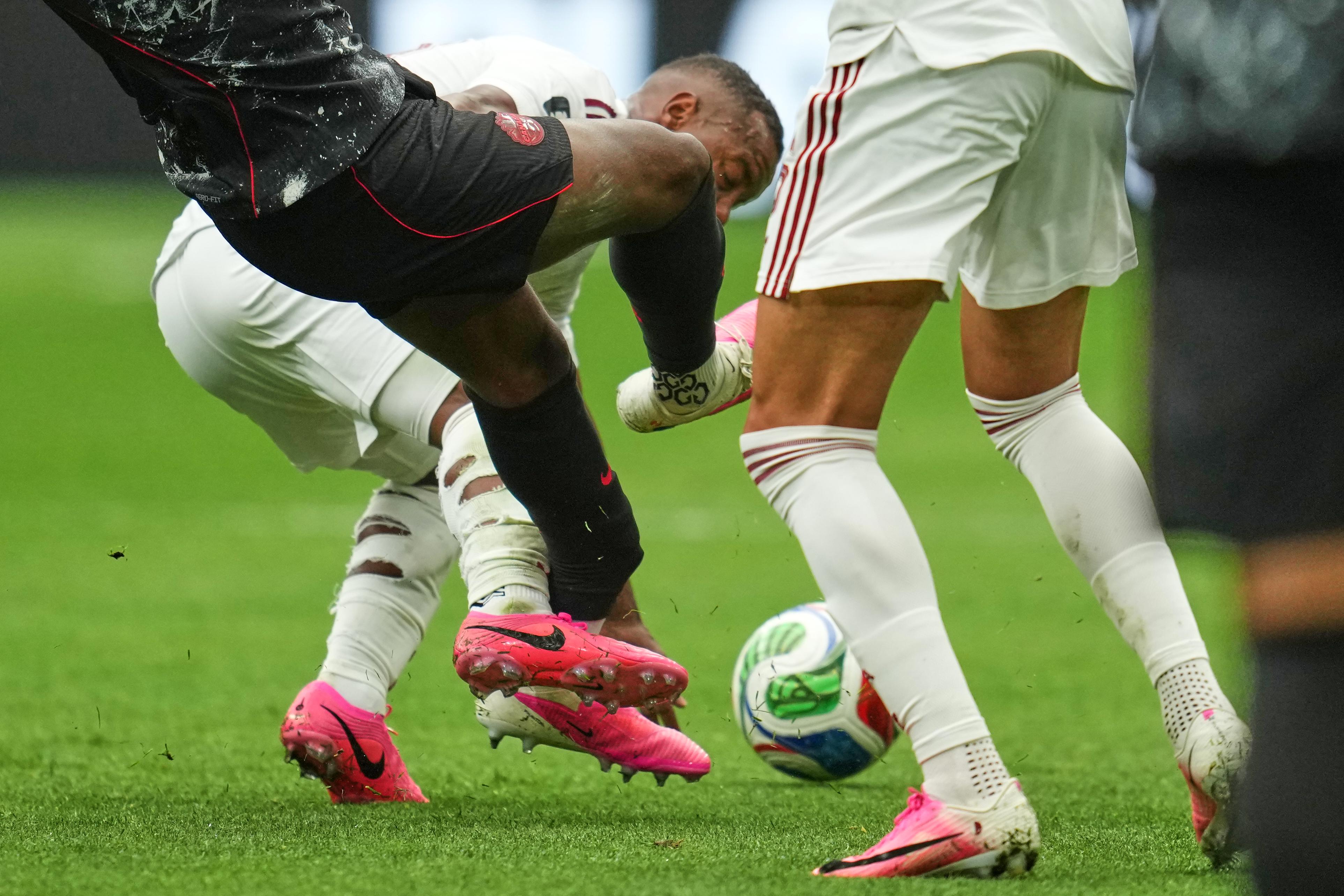 3851x2567 Canada's Koné to undergo surgery after gruesome injury against Qatar