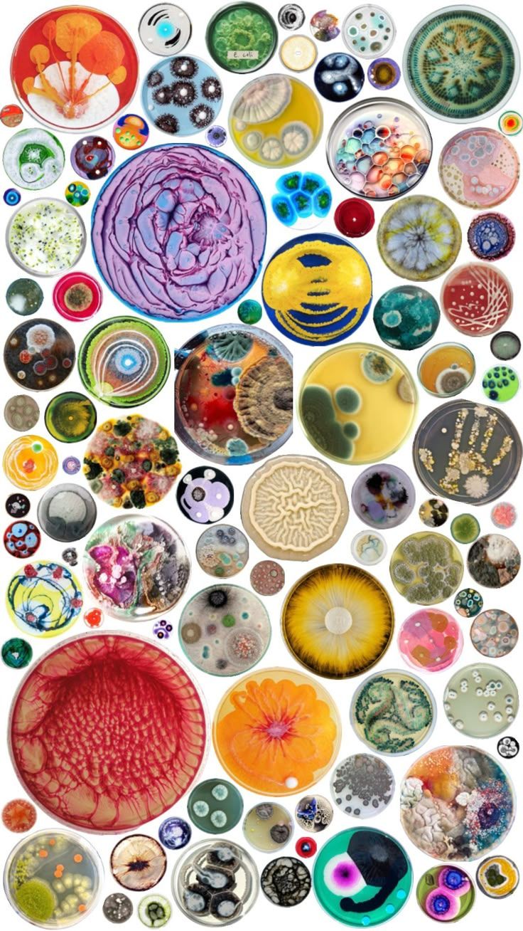 736x1308 Petri dishes #circles #petridish #biologist #fyp