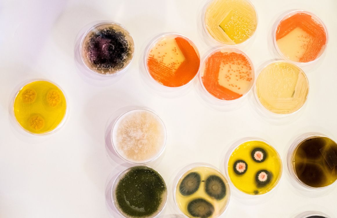 1162x750 Identifying Bacteria in Petri Dishes