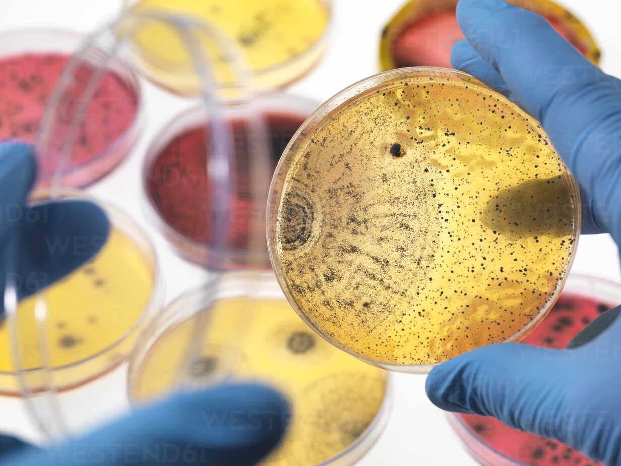 1232x924 Scientist examining petri dishes containing bacterial growth in the laboratory
