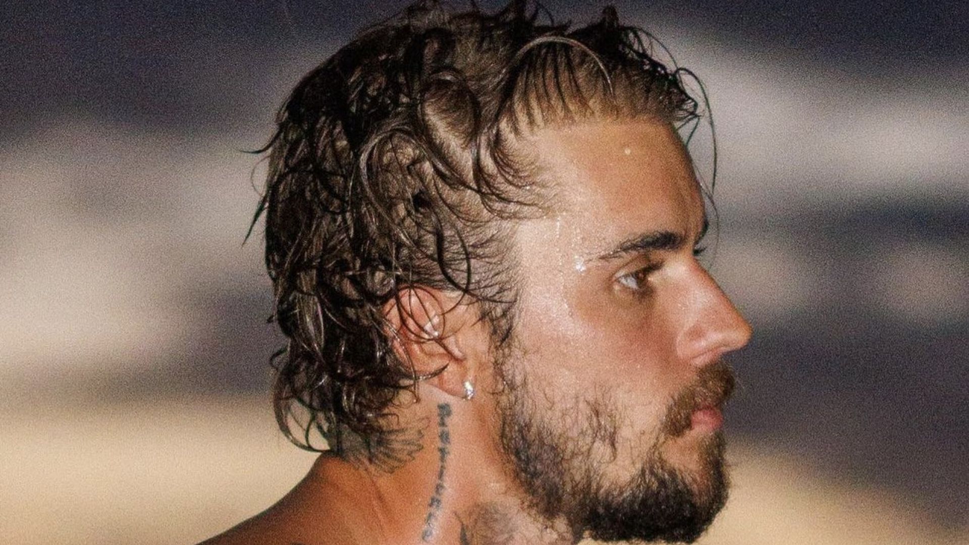 1920x1080 Justin Bieber Hair: Did the Famous Singer Get Hair Transplant? Transplant Turkey Dr Resul Yaman
