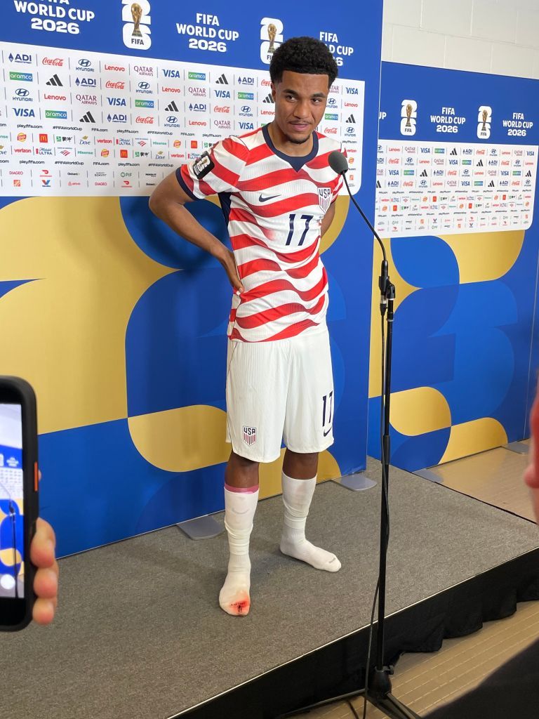 768x1024 Malik Tillman Seen With Bloodied Foot And HOLE In Sock In Behind The Scenes Image After His Freekick For USA Vs Bosnia
