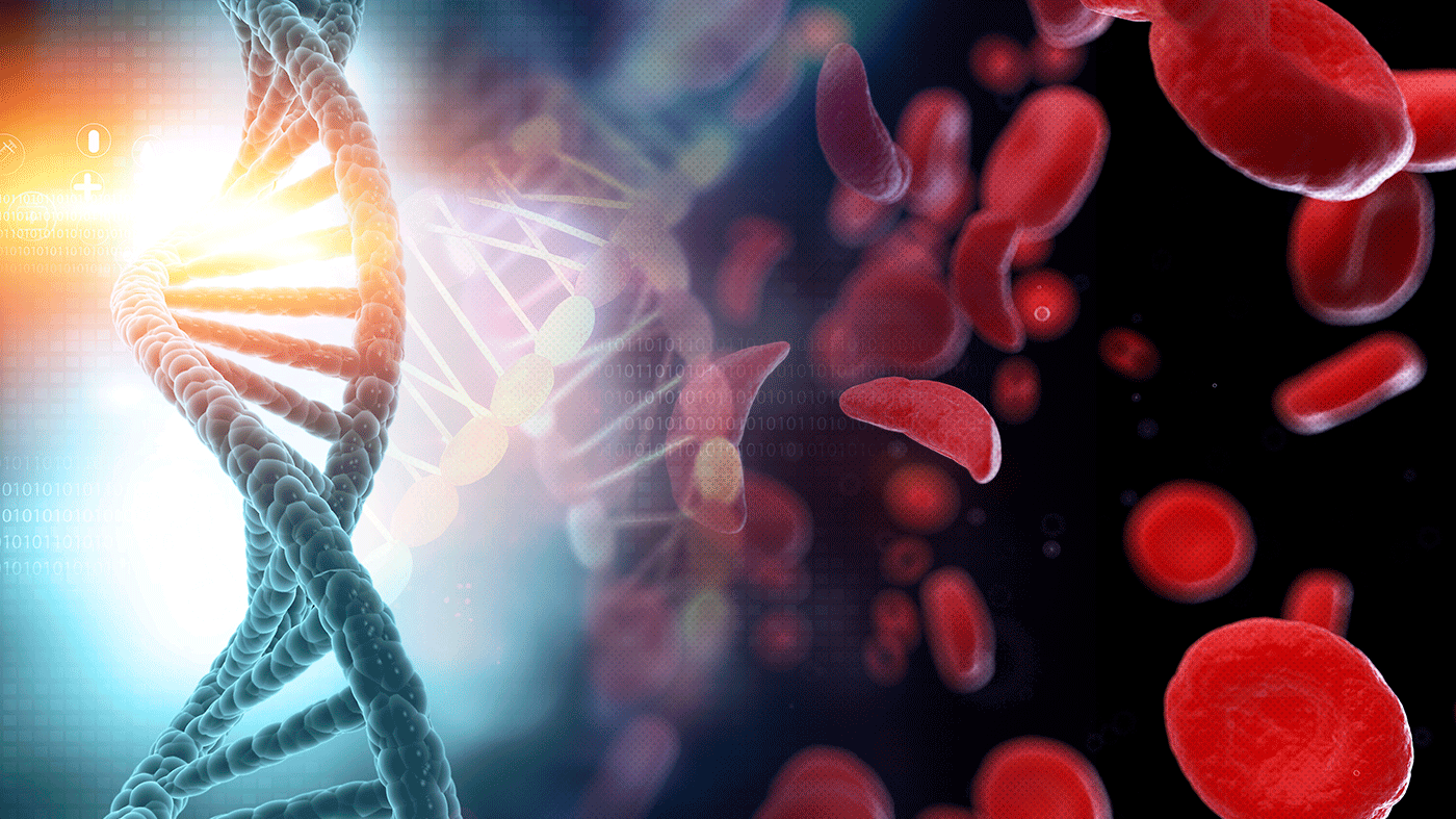 1400x787 This Gene Editing Therapy Could Cure Sickle Cell Disease, And It's Close To FDA Approval