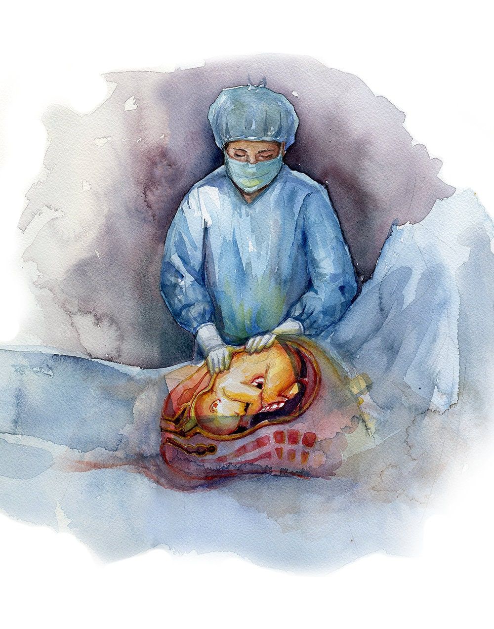 1000x1273 Prepping C Section Watercolor Print Unframed Reproductive Anatomy Print Art Surgery Art Anatomy Watercolor