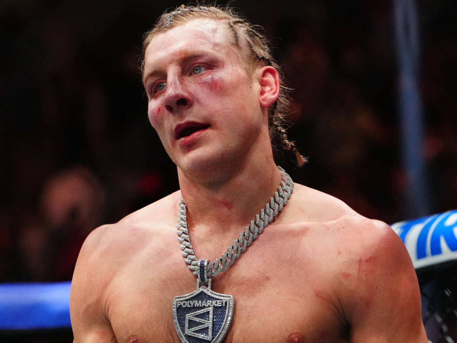 1600x1200 Paddy Pimblett Breaks Silence After UFC 324 Defeat With Medical Update