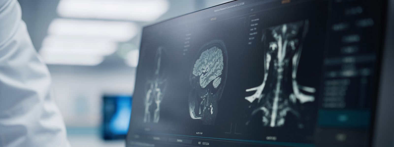 1600x600 Home & Radiologist Recruitment Firm. Med Dox iFind