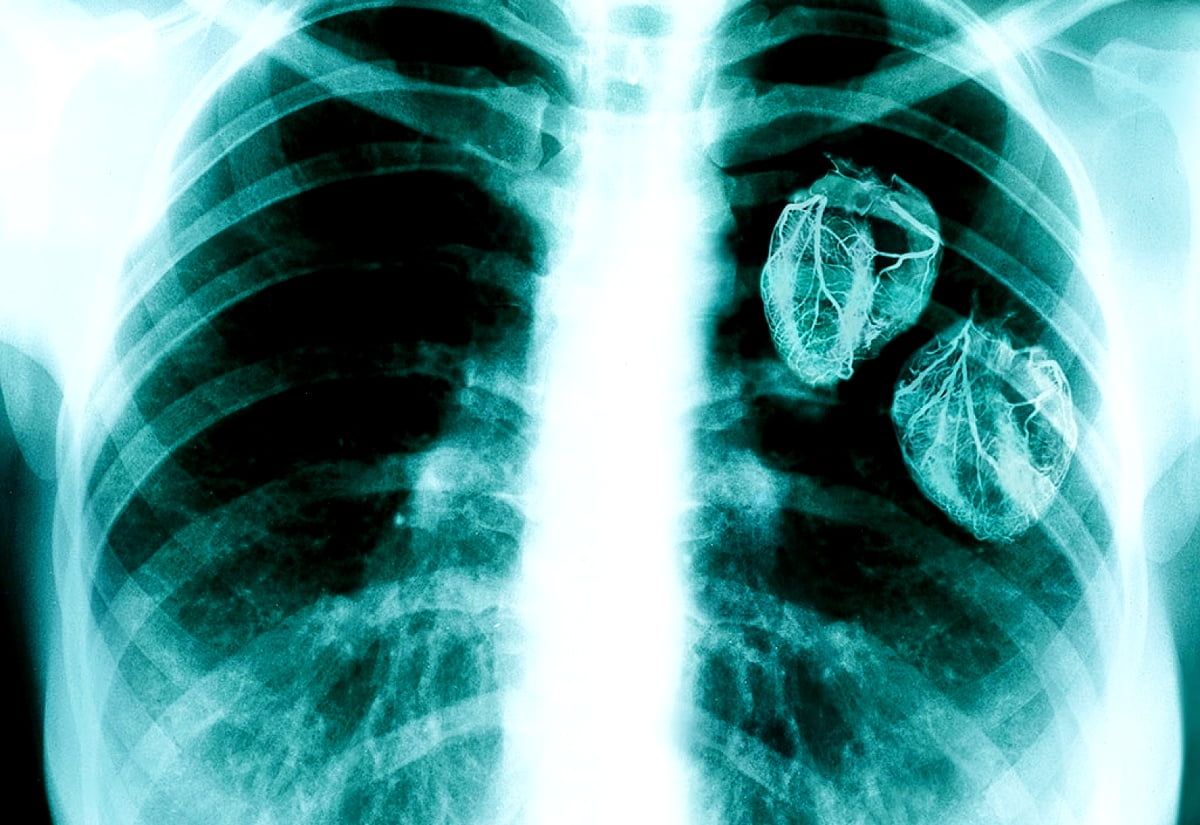 1200x825 Medical radiography wallpaper HD. Download Free background