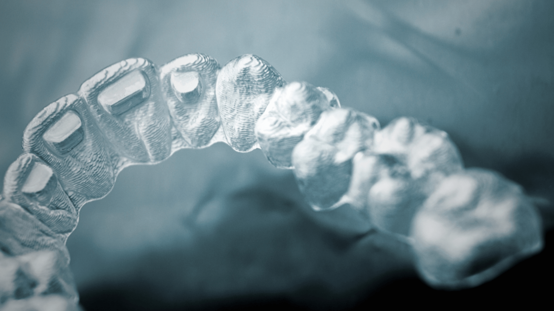 1920x1080 Invisalign vs braces: 7 reasons to choose Invisalign aligners Design Boutique