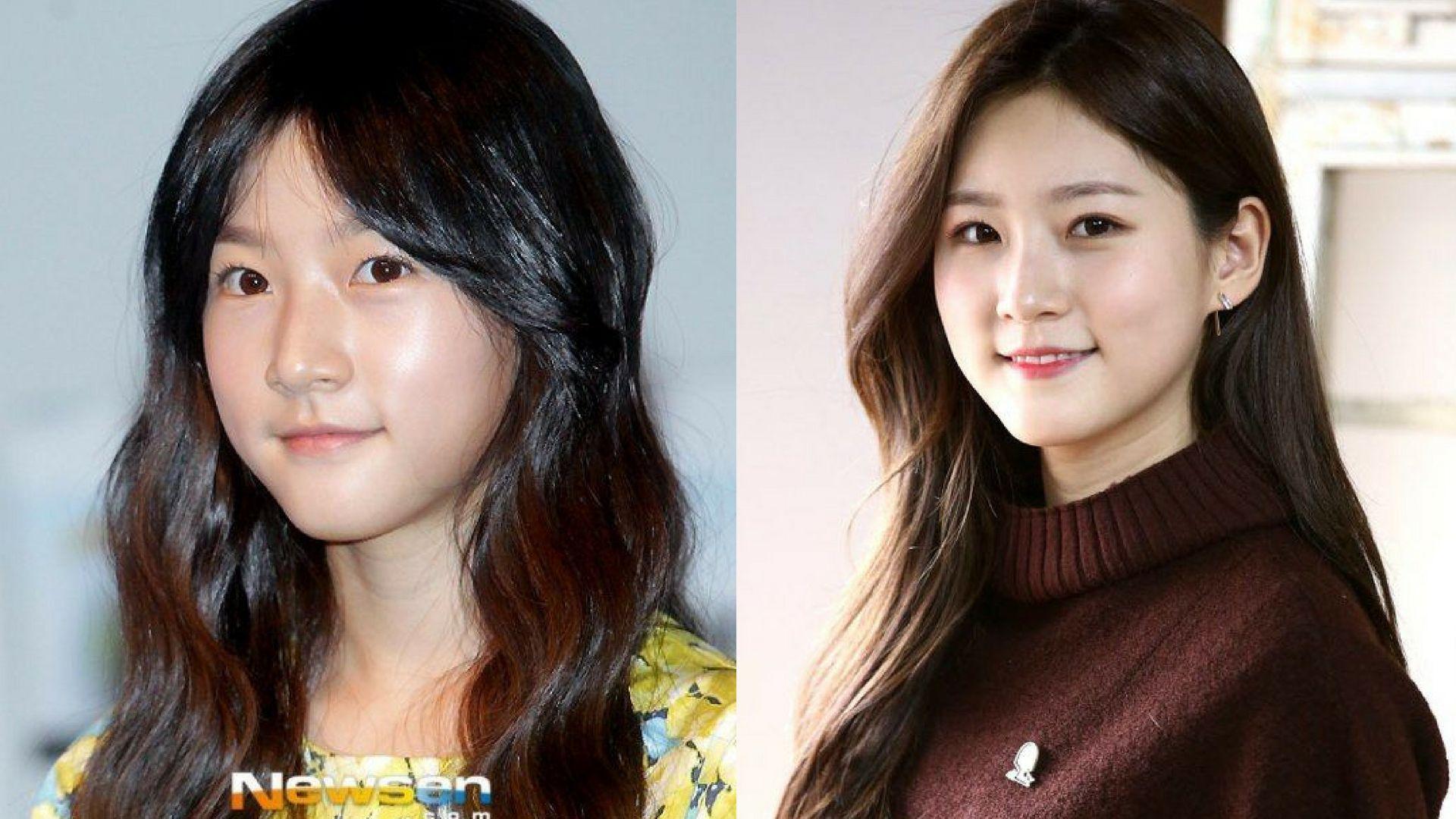 1920x1080 About Kim Sae Ron: Profile, Dramas, Sister, Movies, TV Shows, And Surgery