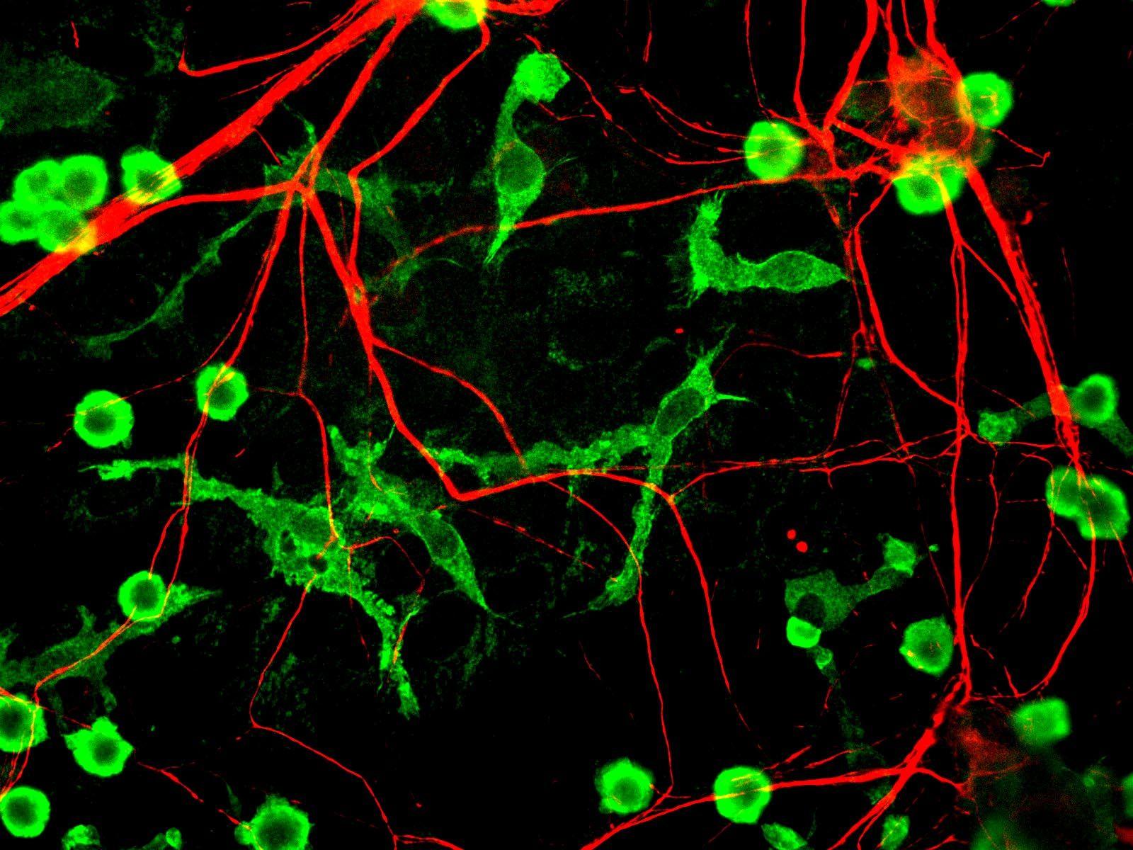 1600x1200 Neurology on ZME Science