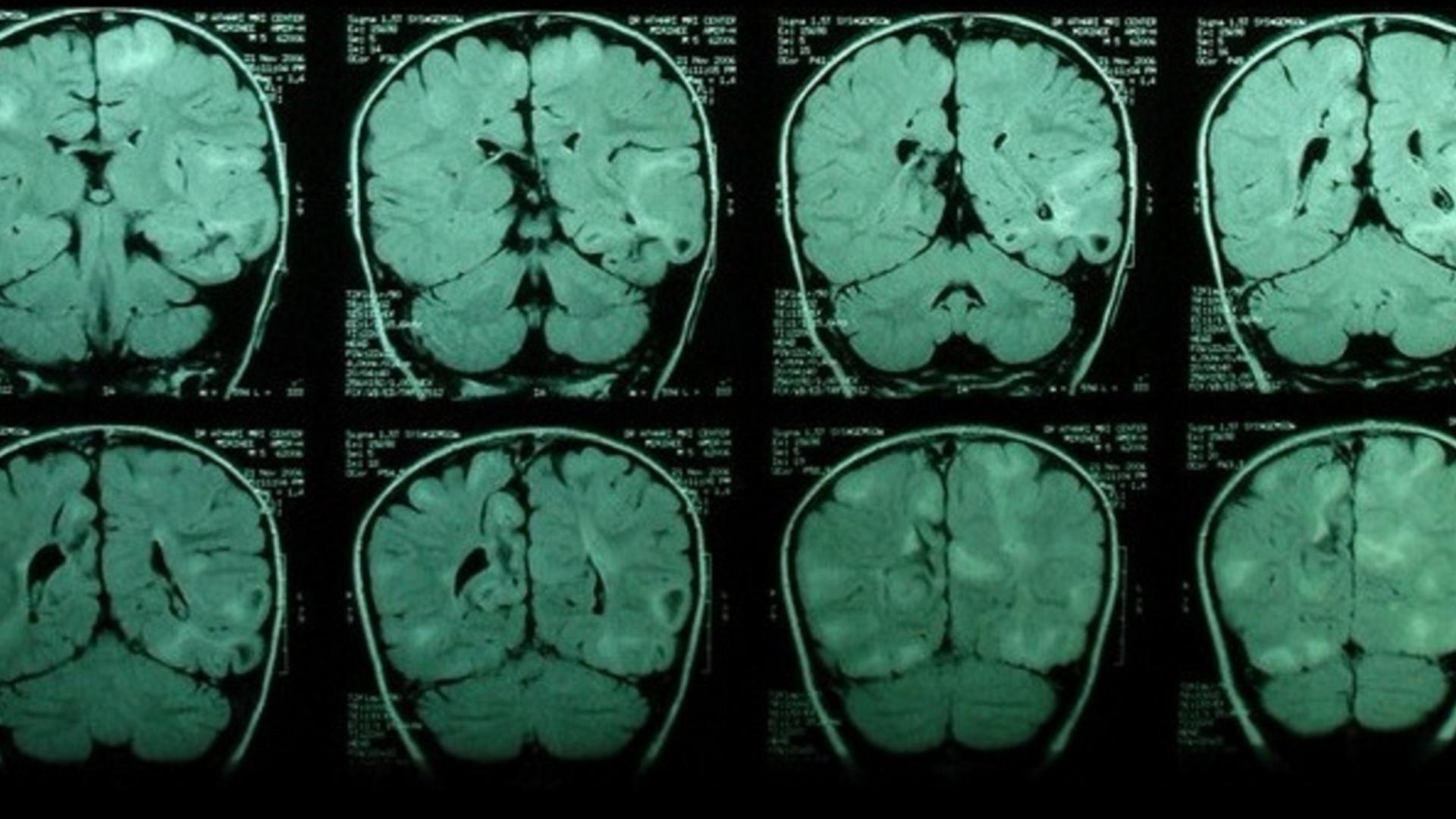 1920x1080 Skulls medicine brain doctors diseases scans mri wallpaper