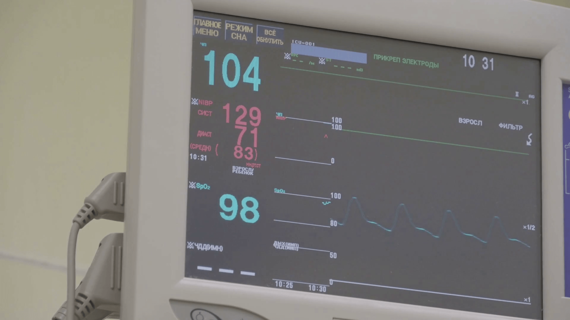 1920x1080 Display of medical monitor show The waves of blood pressure, blood oxygen saturation, ECG, heart rate