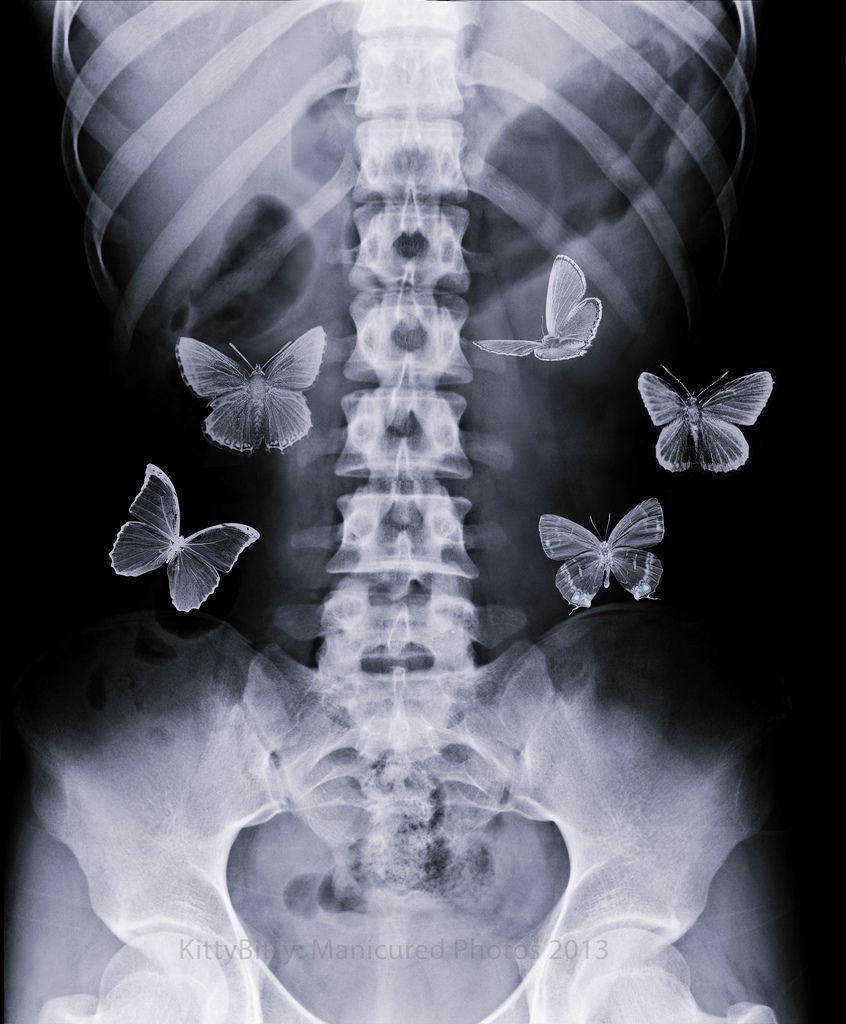 846x1024 Butterflies. Aesthetic art, Butterfly poster, Aesthetic collage