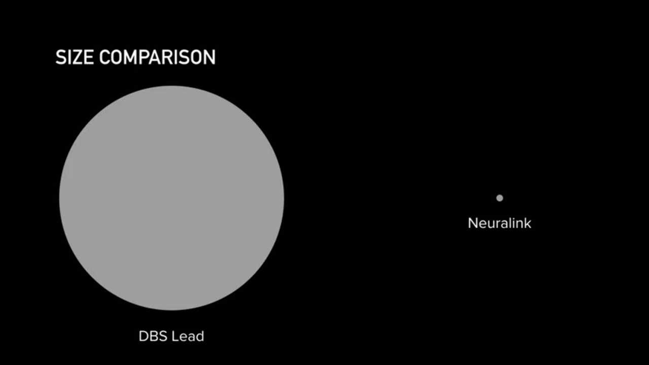 1280x720 Elon Musk Presents Neuralink, A Revolutionary Brain Implant