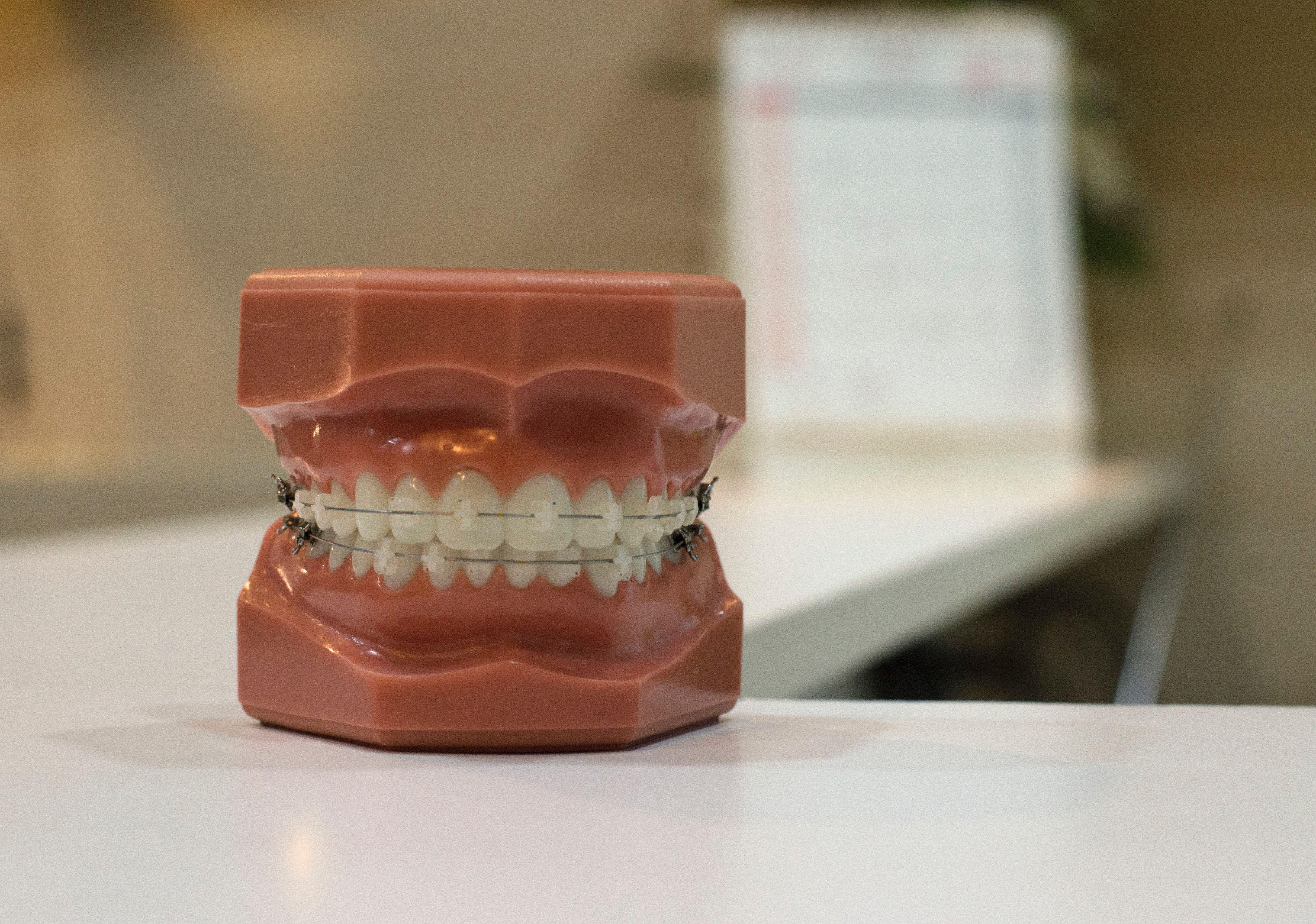 5673x3982 5673x3982 #visit, #orthodontic, #mouth, #lip, #bokeh, #teeth, #class, #dental, #blur, #example, #appointment, #model, #learn, #fake, #doctor, #Free , #dentist, #brace, #wire, #teach, #school. Mocah.org HD Desktop Wallpaper