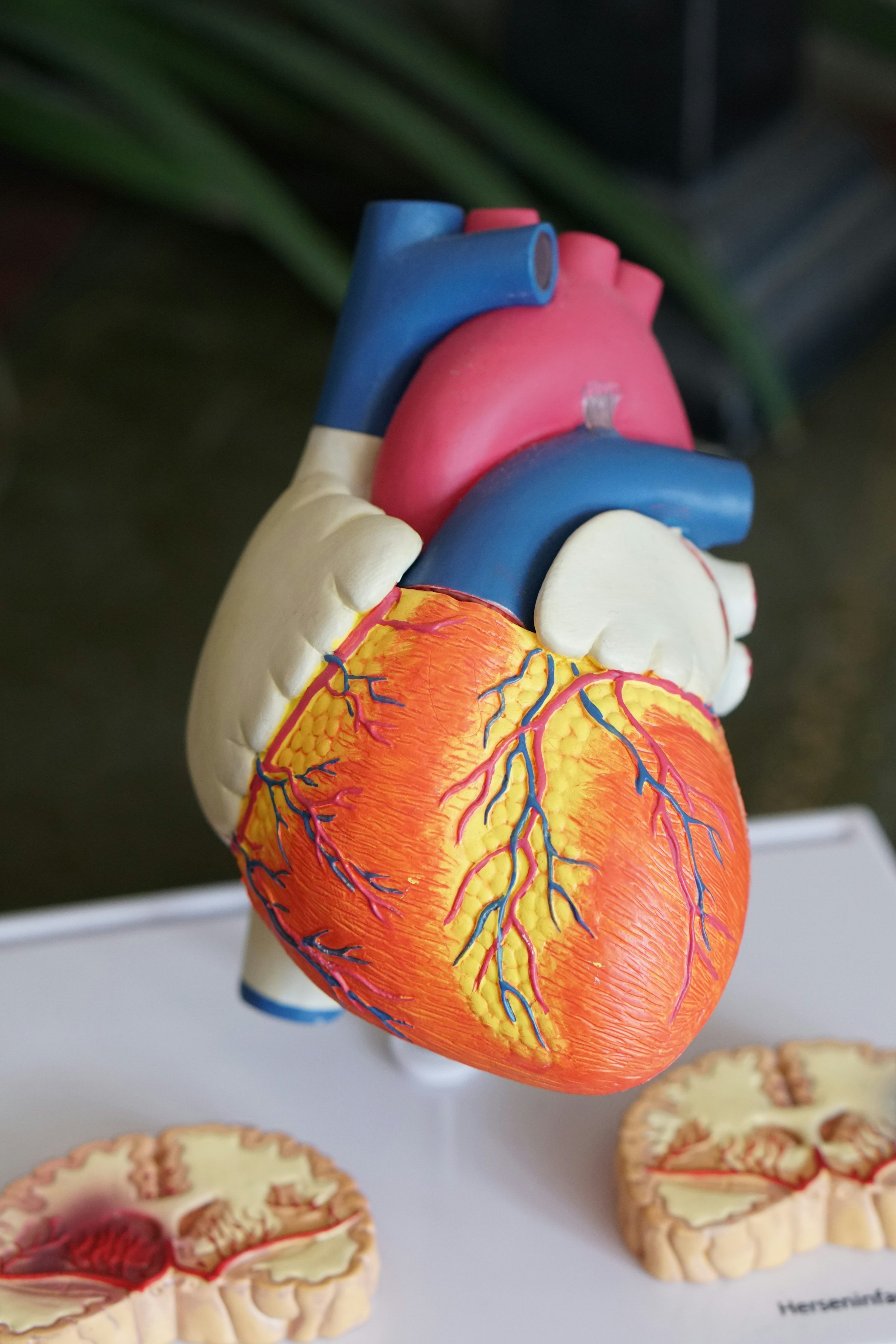 3000x4500 Orange heart decor photo