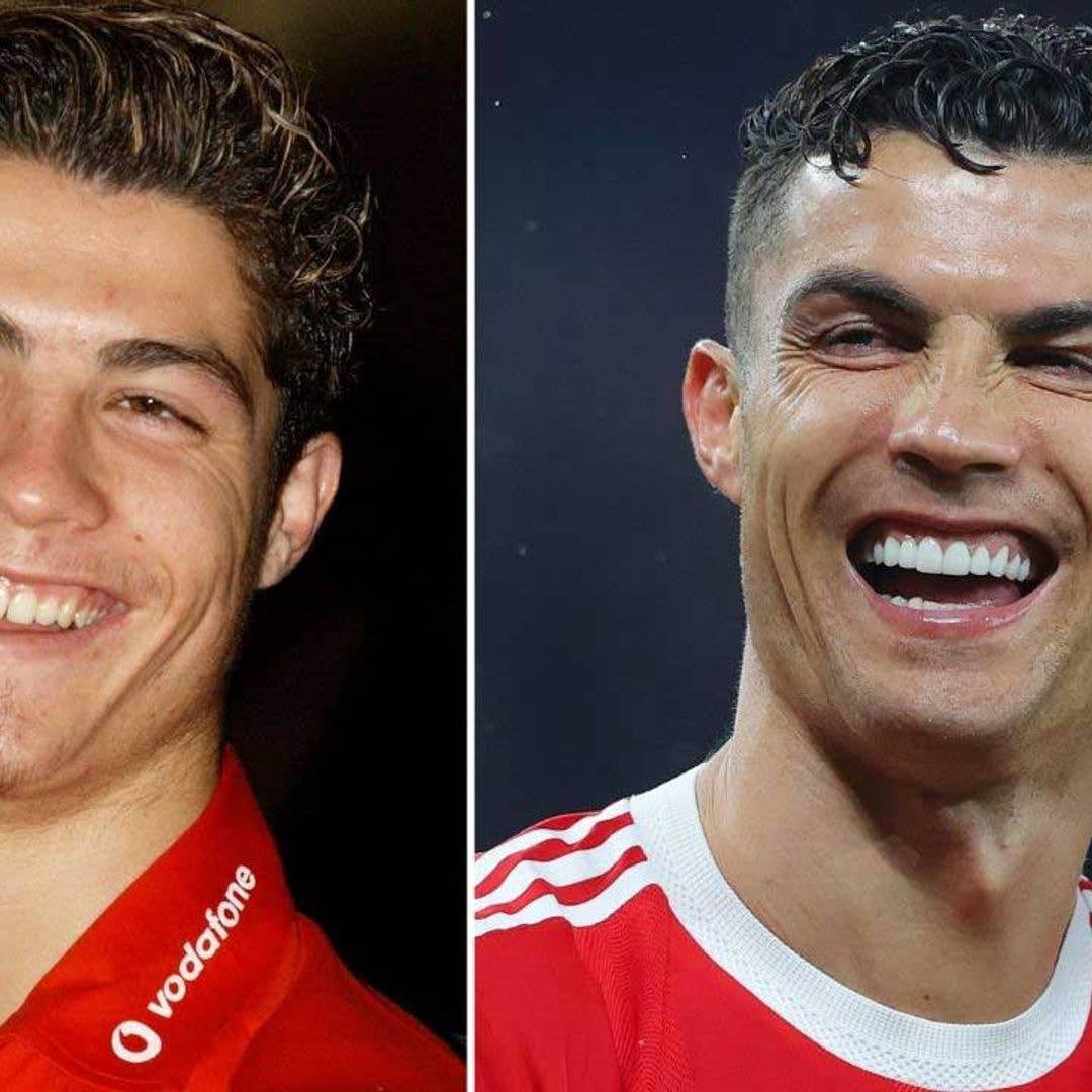 1080x1080 Cristiano Ronaldo smile transformation before and after: What has the footballer done to his teeth?