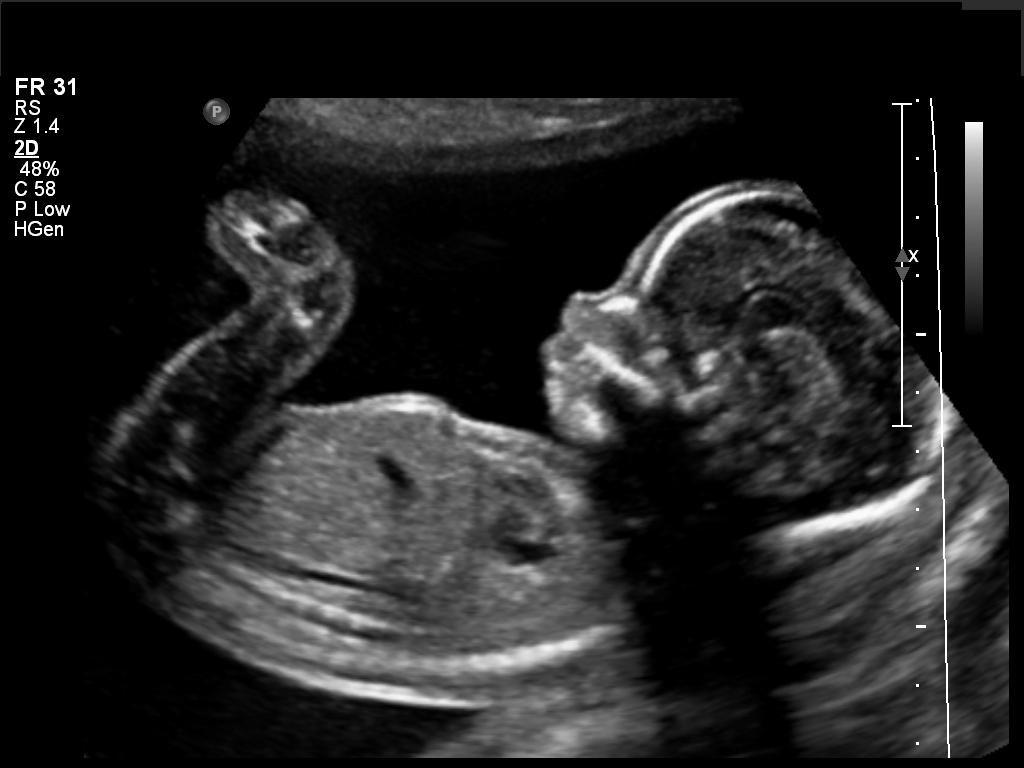 ultrasound-wallpapers-top-free-ultrasound-backgrounds-wallpaperaccess
