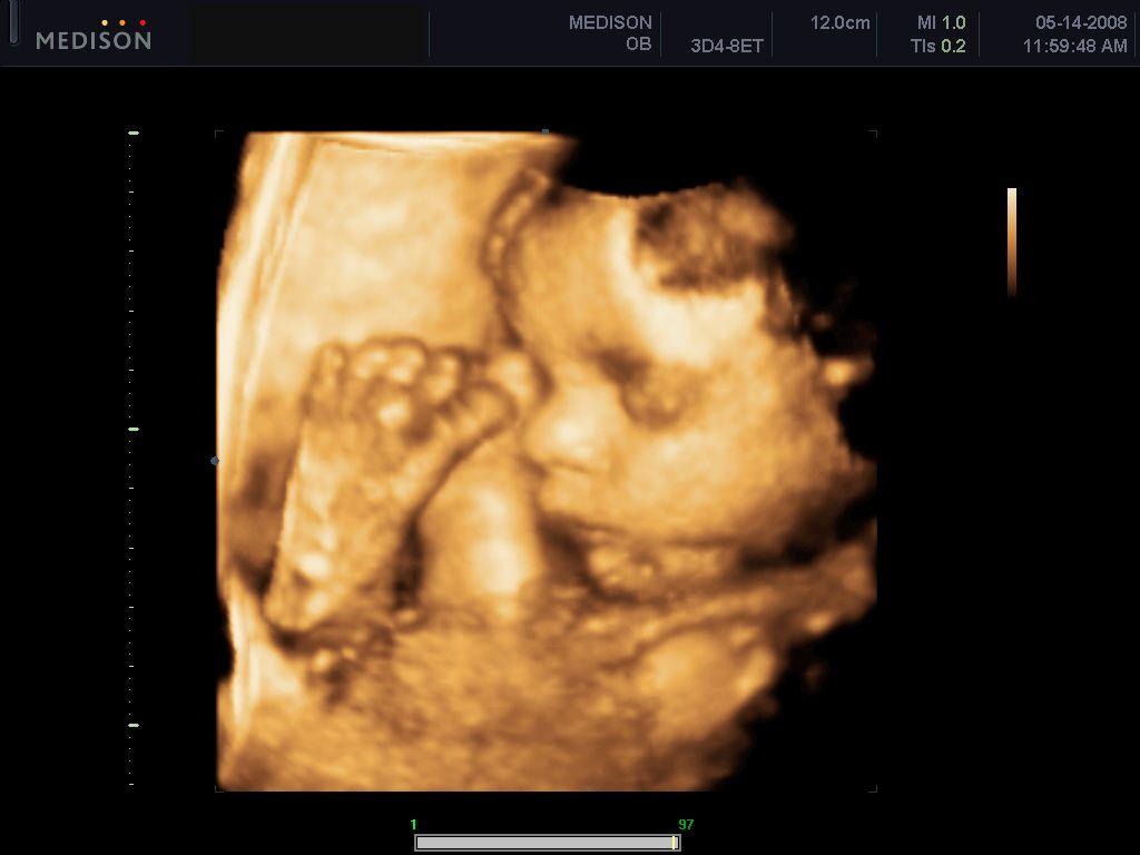 Ultrasound Wallpapers - Top Free Ultrasound Backgrounds - WallpaperAccess