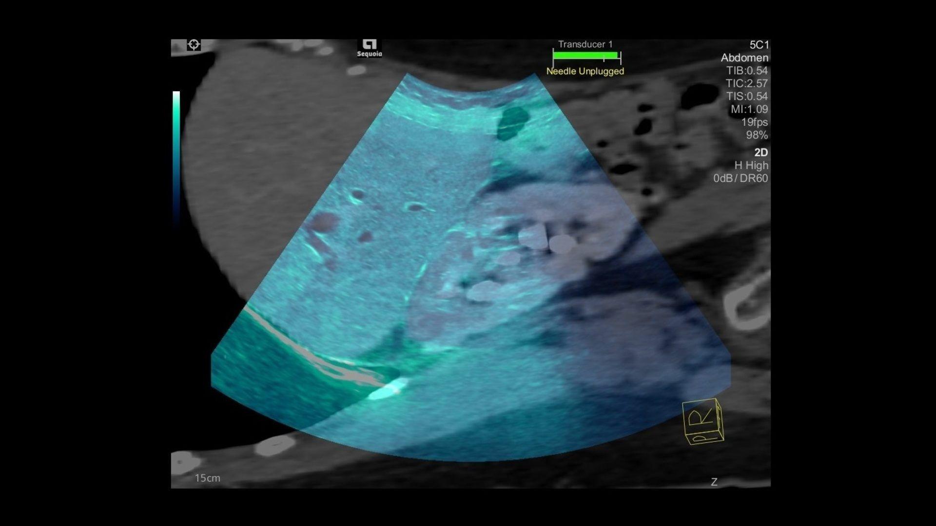 Ultrasound Wallpapers - Top Free Ultrasound Backgrounds - WallpaperAccess