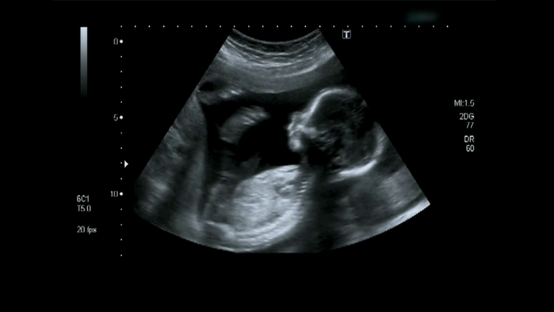 Ultrasound Wallpapers Top Free Ultrasound Backgrounds WallpaperAccess