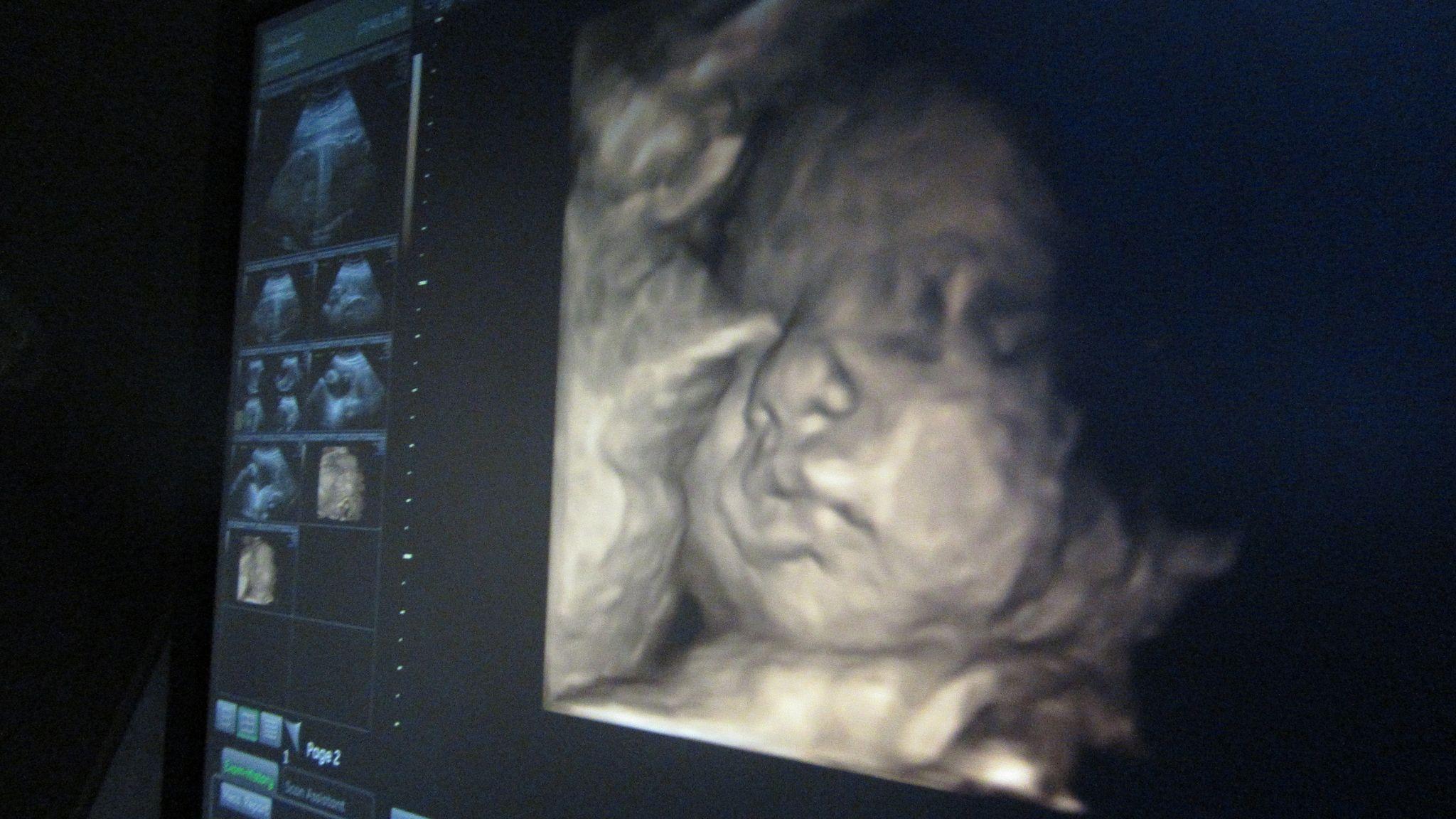 Ultrasound Wallpapers - Top Free Ultrasound Backgrounds - WallpaperAccess