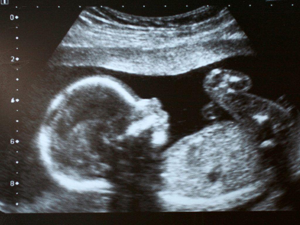 Ultrasound Wallpapers - Top Free Ultrasound Backgrounds - WallpaperAccess