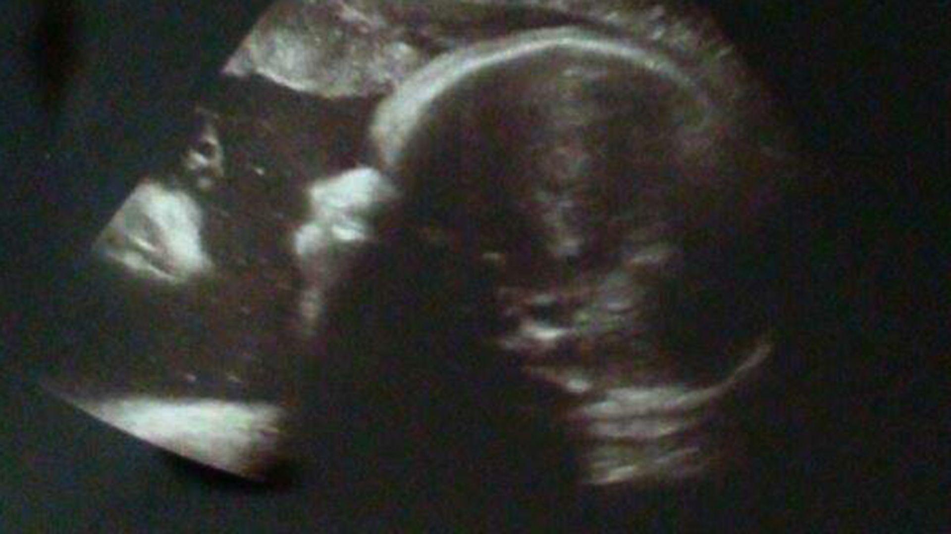 1920x1080 Couple sees image of Jesus in baby's ultrasound
