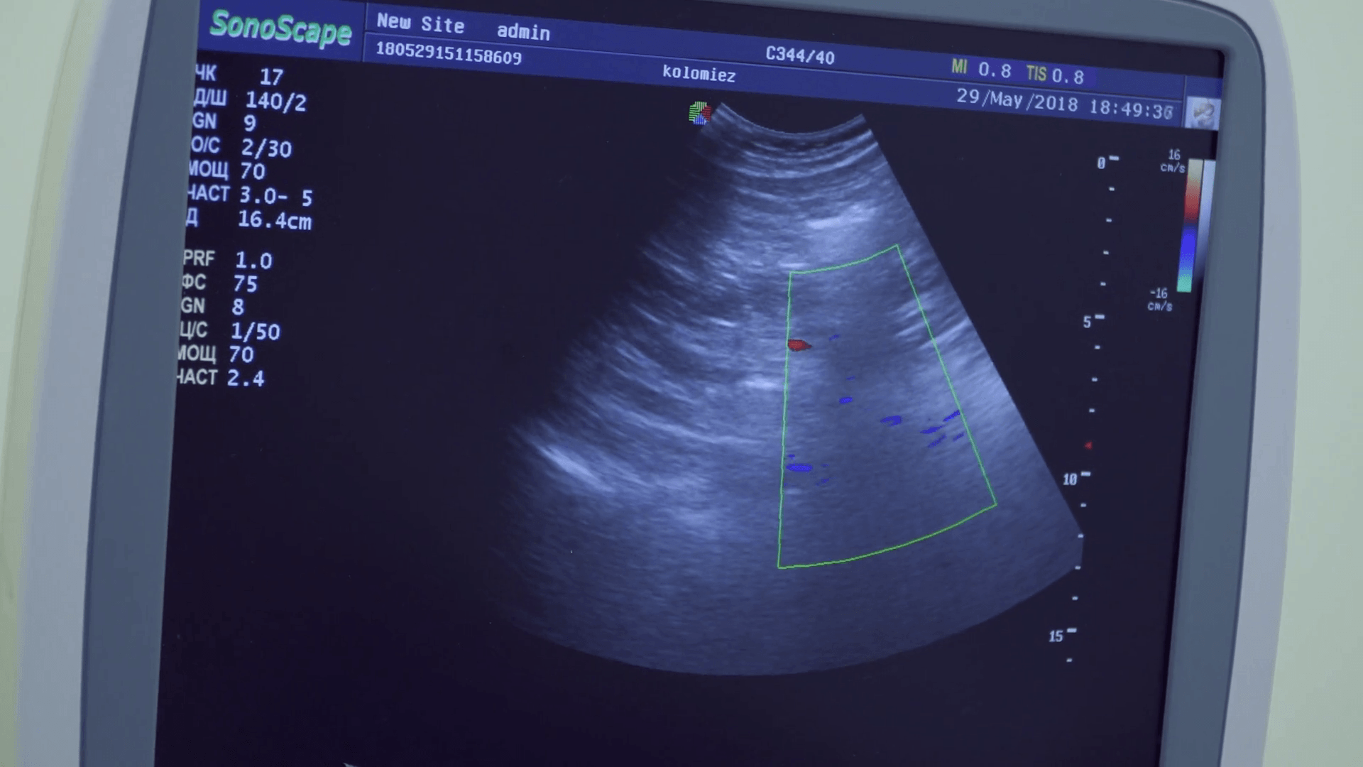 Ultrasound Wallpapers - Top Free Ultrasound Backgrounds - WallpaperAccess