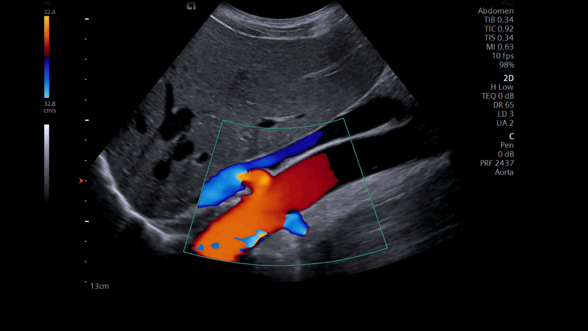 Ultrasound Wallpapers - Top Free Ultrasound Backgrounds - WallpaperAccess