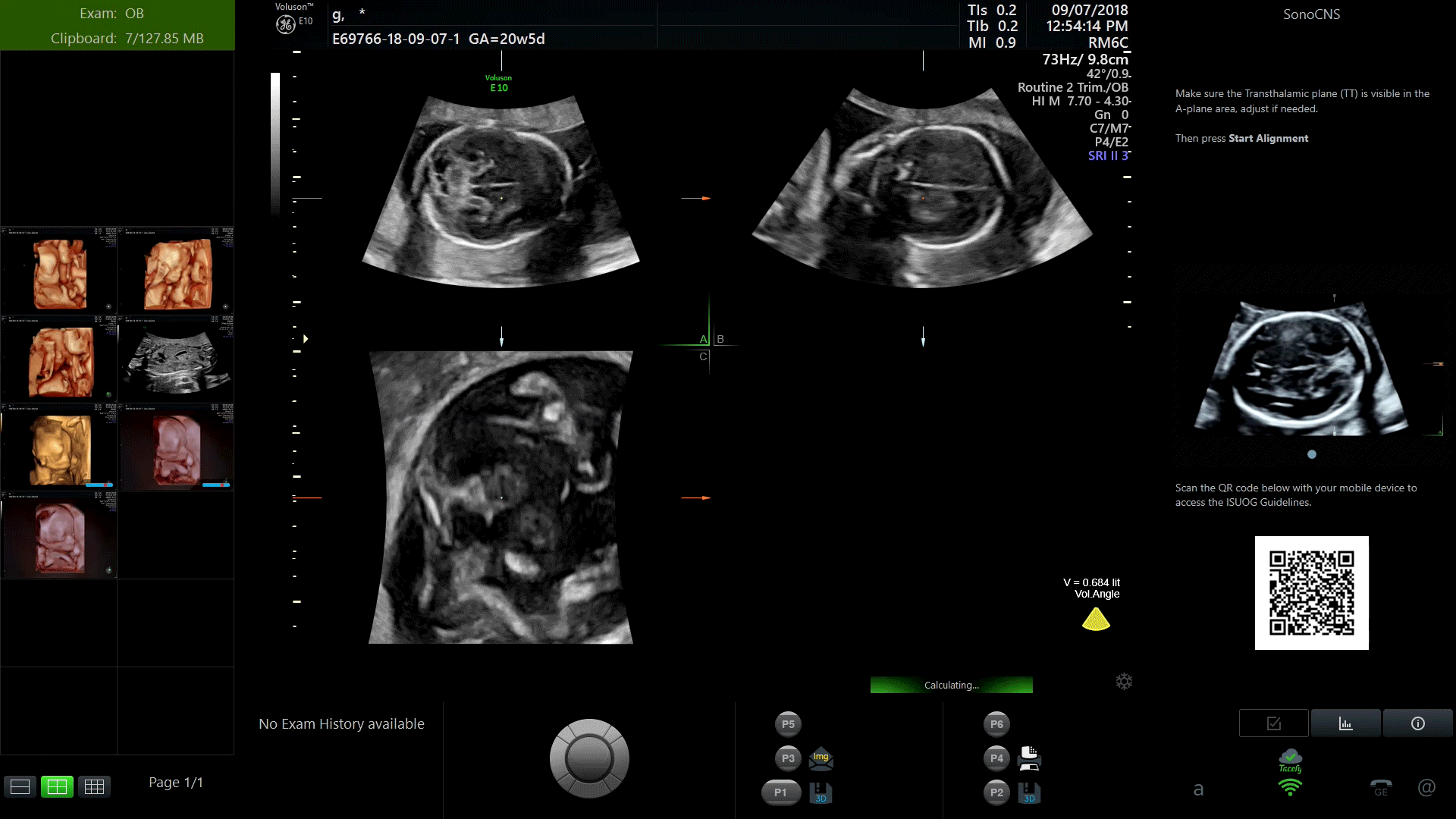 Ultrasound Wallpapers - Top Free Ultrasound Backgrounds - WallpaperAccess