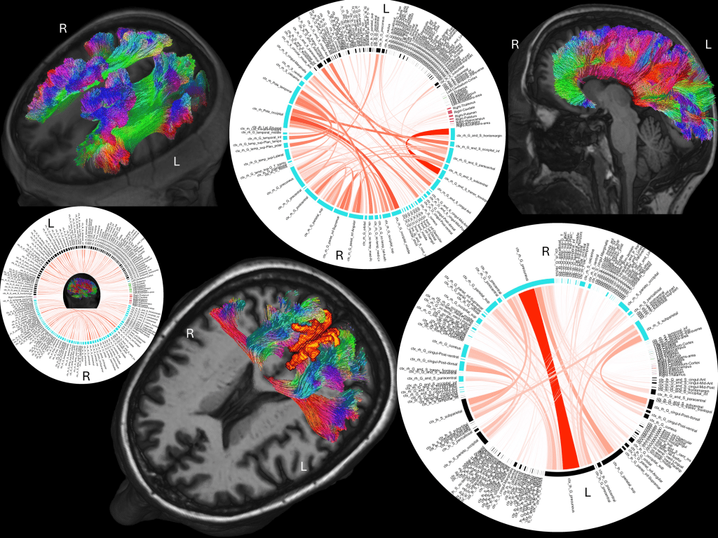 1024x768 How advanced MRI paired with neuropsychological testing shed light on how Temple Grandin's brain processes the world