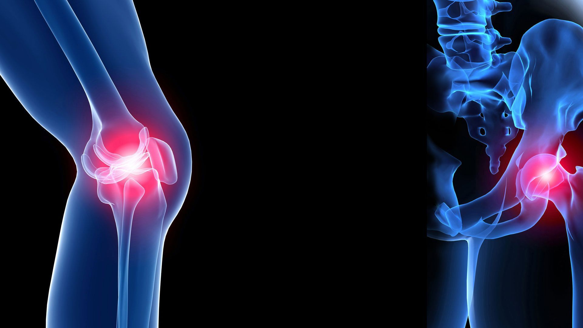 1920x1080 Orthopedic Wallpaper