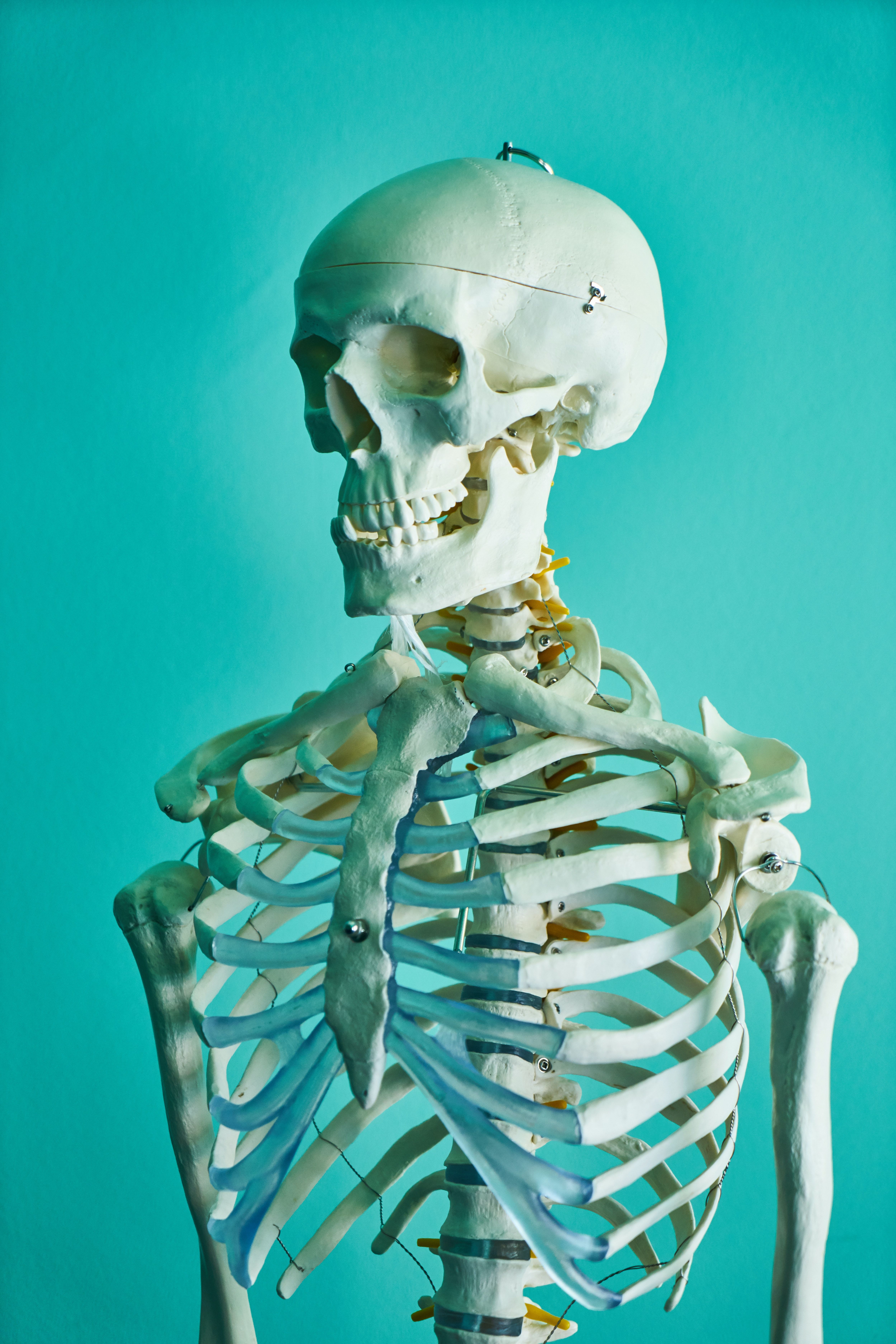 4996x7490 Successful Defense of Orthopedic Surgeon Against Claims Total Hip Replacement Surgery Caused Sciatic Nerve Injury Dymott Hudson, APLC