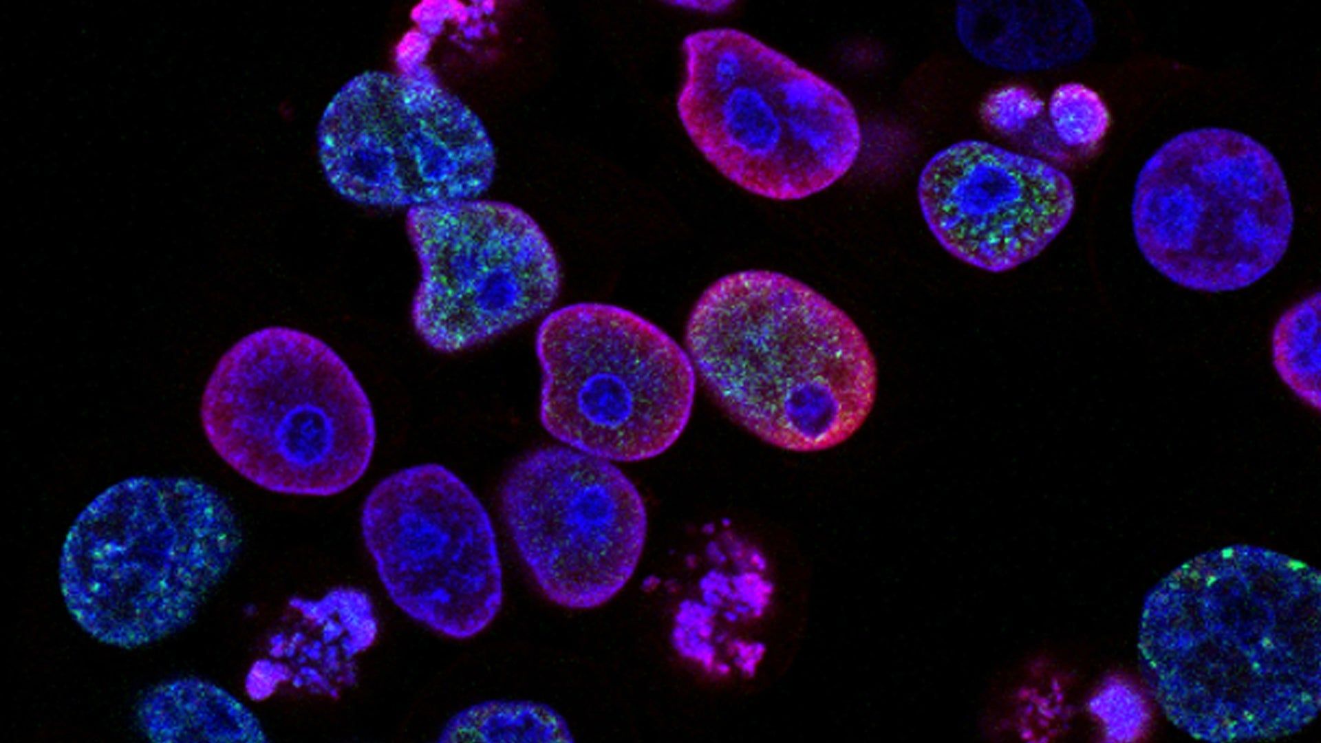 1920x1080 HOW THE SPLEEN PLAYS A ROLE IN THE IMMUNE SYSTEM