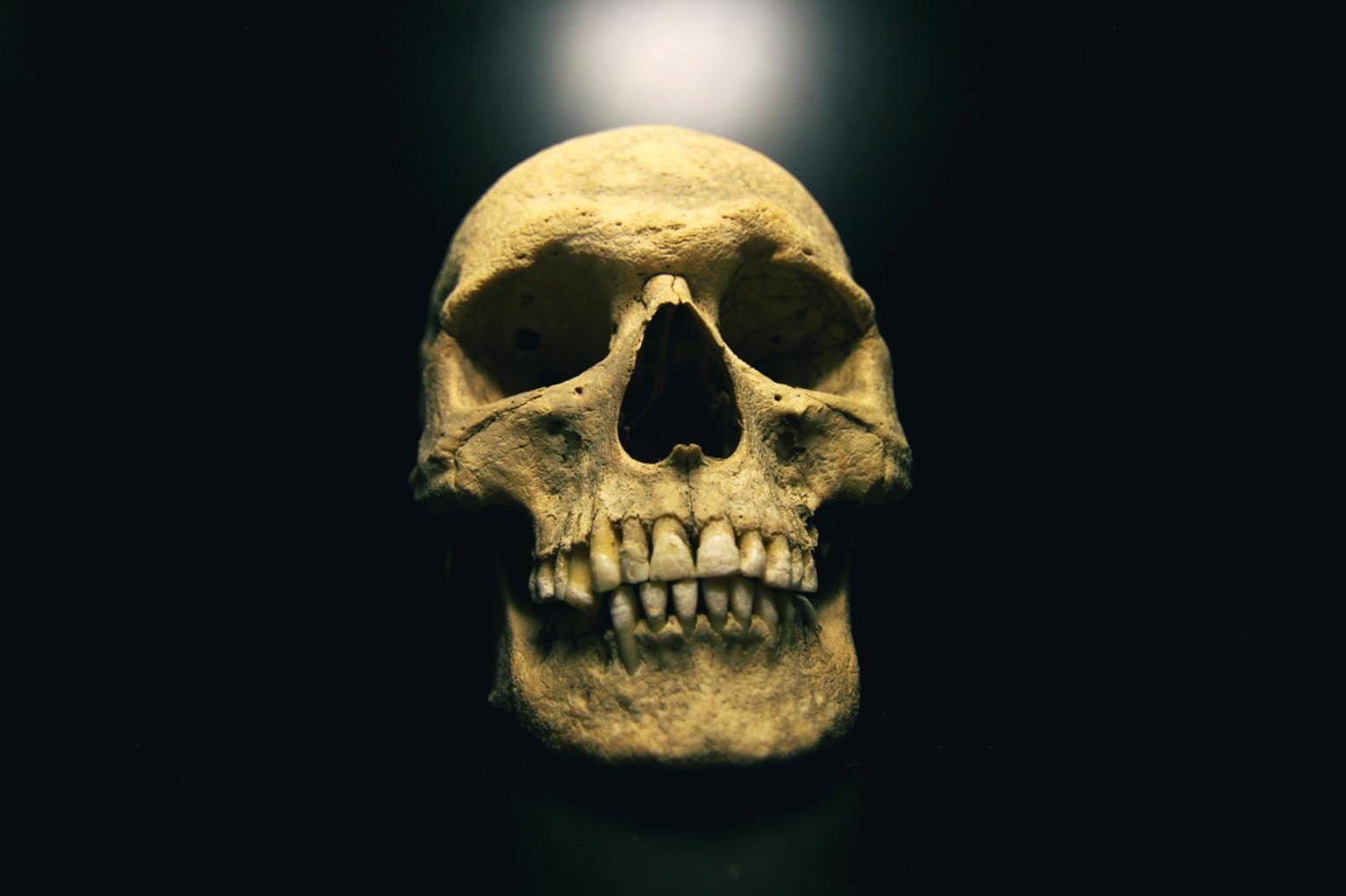 1535x1023 Free picture: skull, anthropology, bone, anatomy, human head