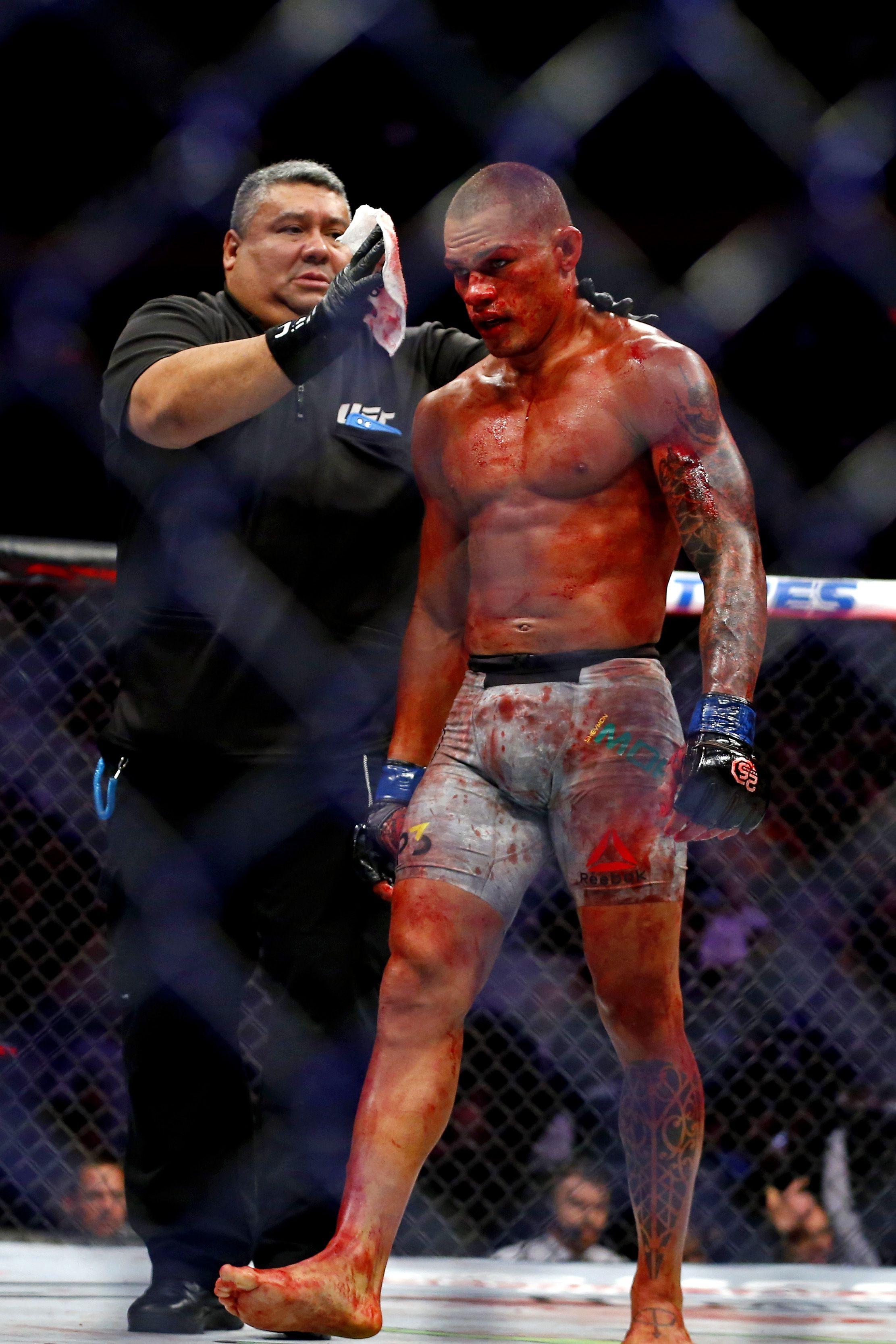 2223x3335 Ufc Blood