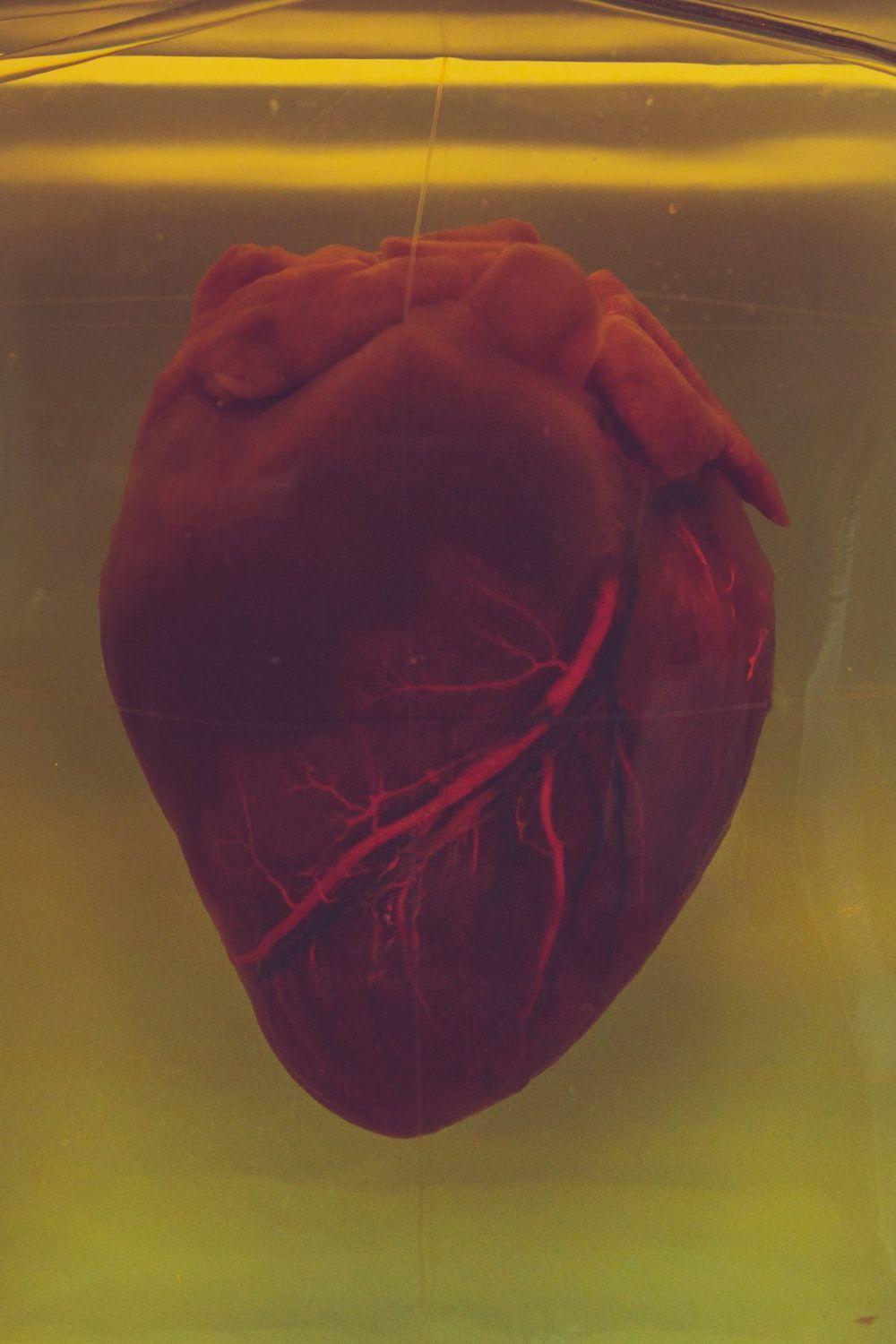 1000x1500 Heart Attack Picture [HD]. Download Free Image