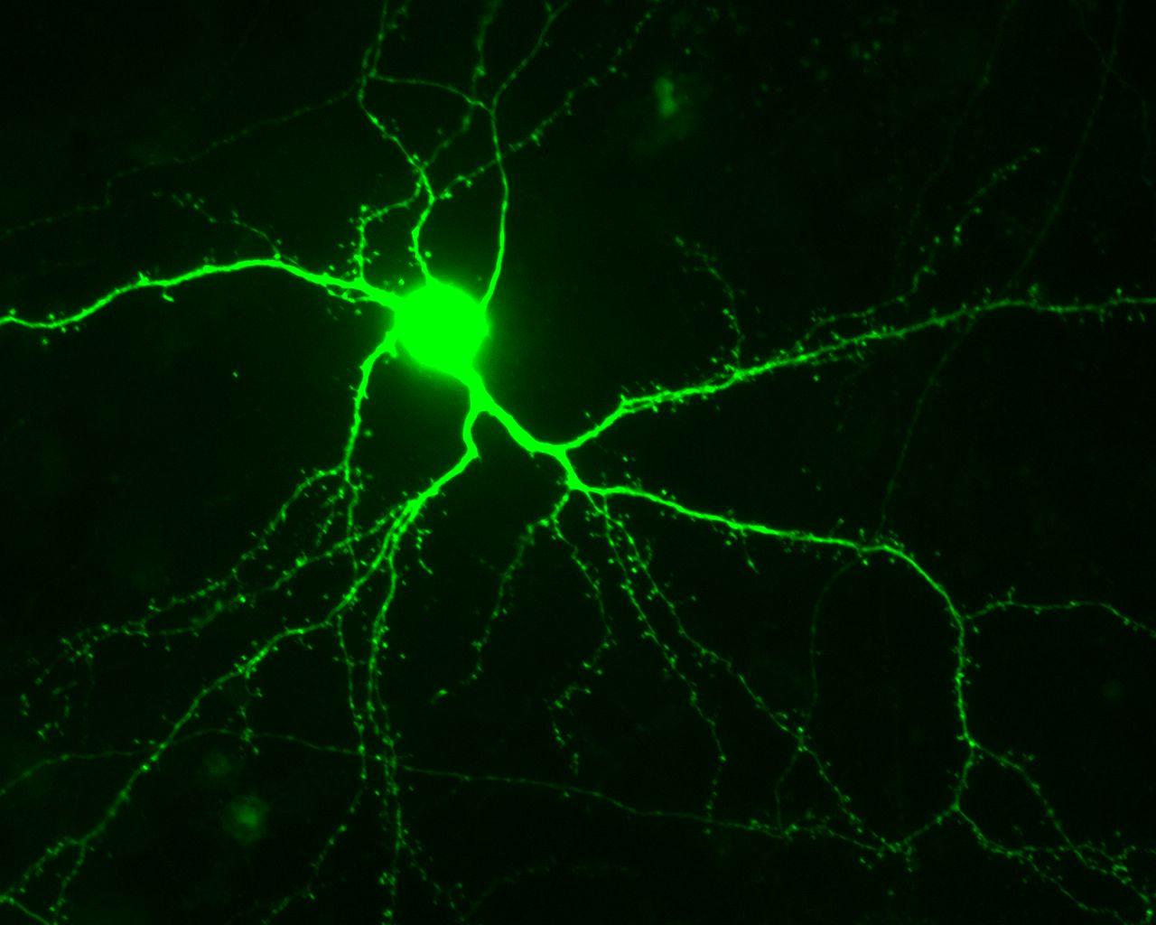 1280x1024 Neurology Wallpaper on .
