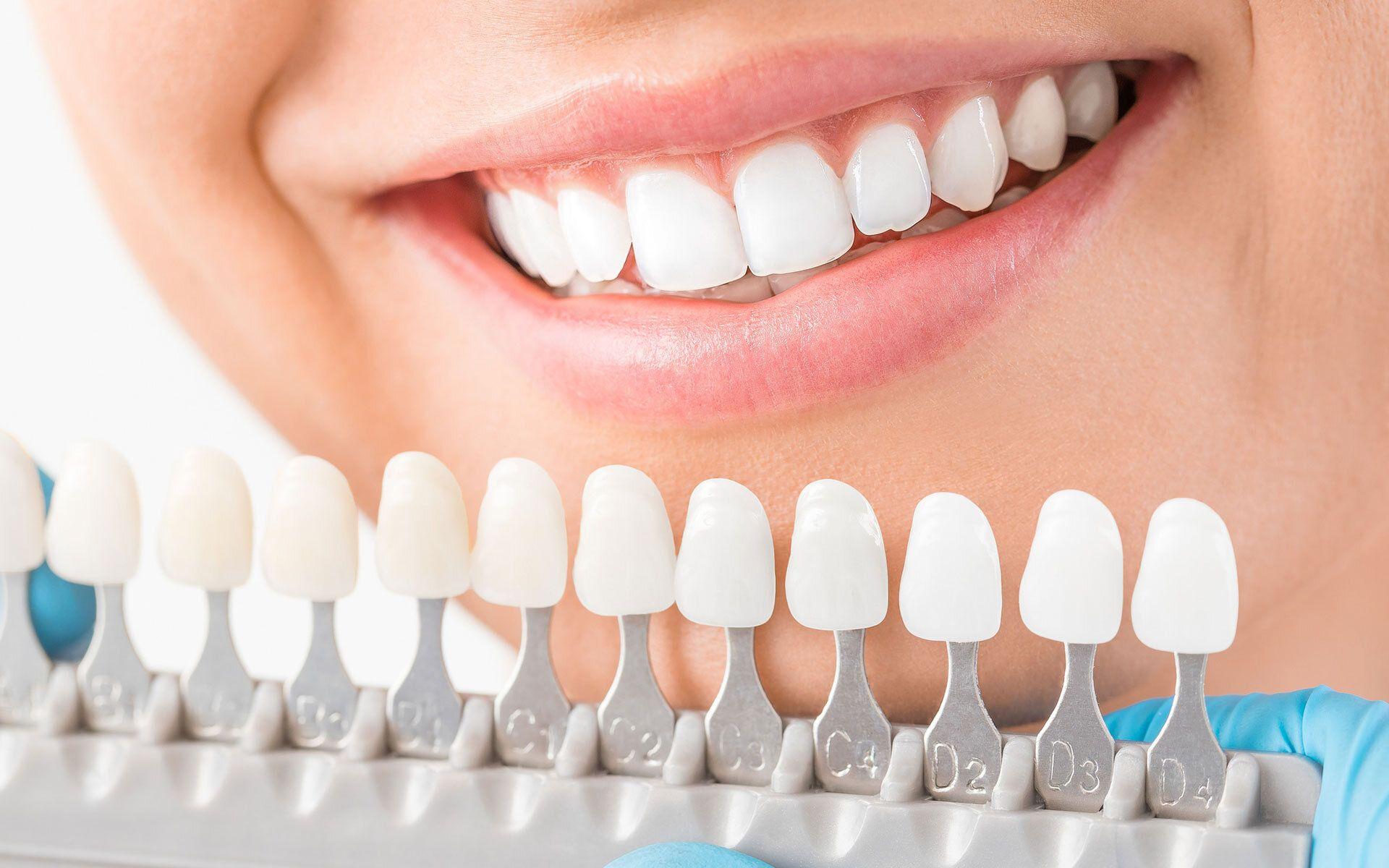 1920x1200 Care of My Dental Implants .