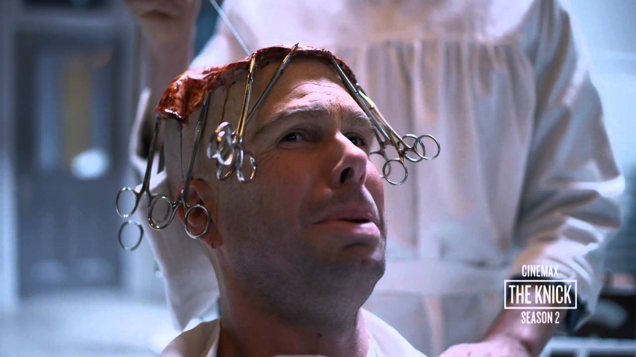 1280x720 The Knick Season 2: Body Shop Brain .