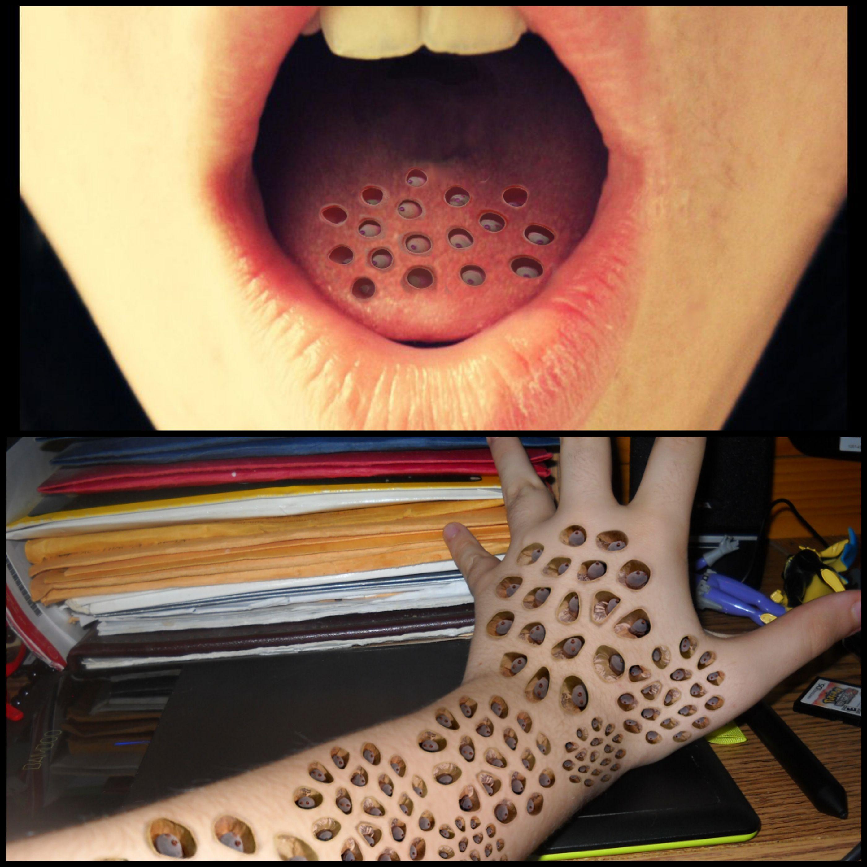 2800x2800 trypophobia. Trypophobia, Superhero wallpaper, 10 things